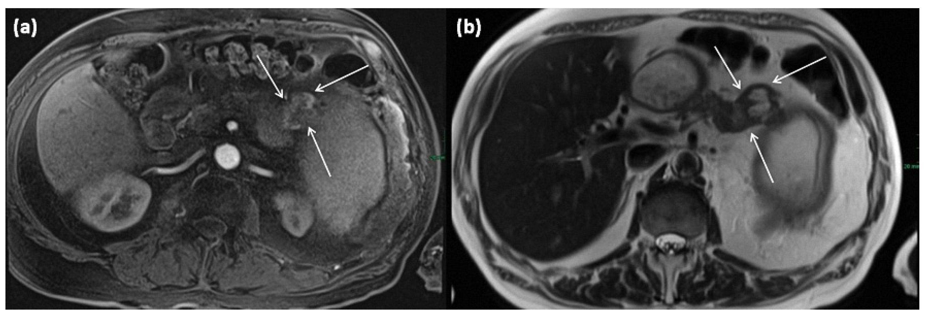 Diagnostics 13 00454 g016 Diagnostics 13 00454 g016
