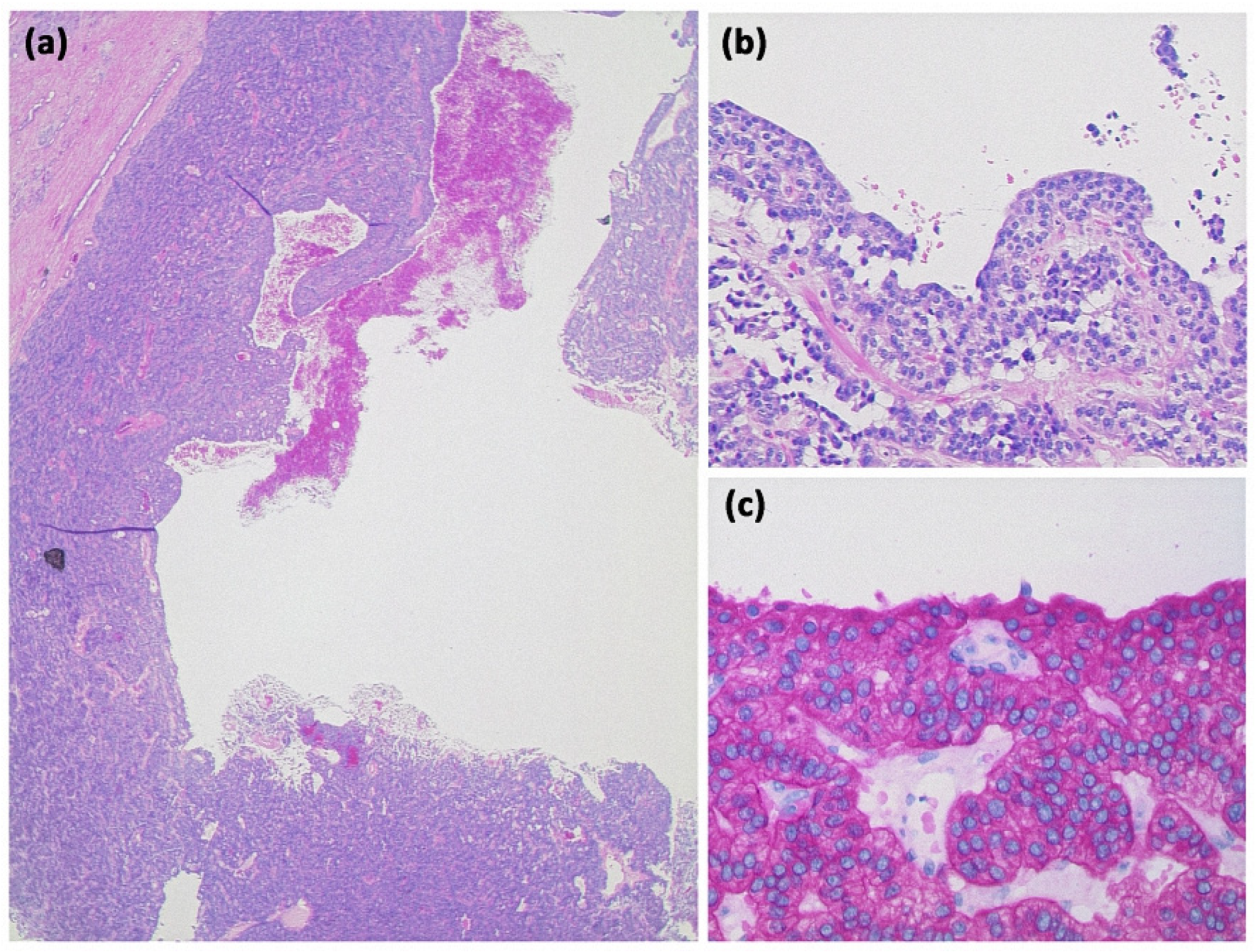 Diagnostics 13 00454 g017 Diagnostics 13 00454 g017