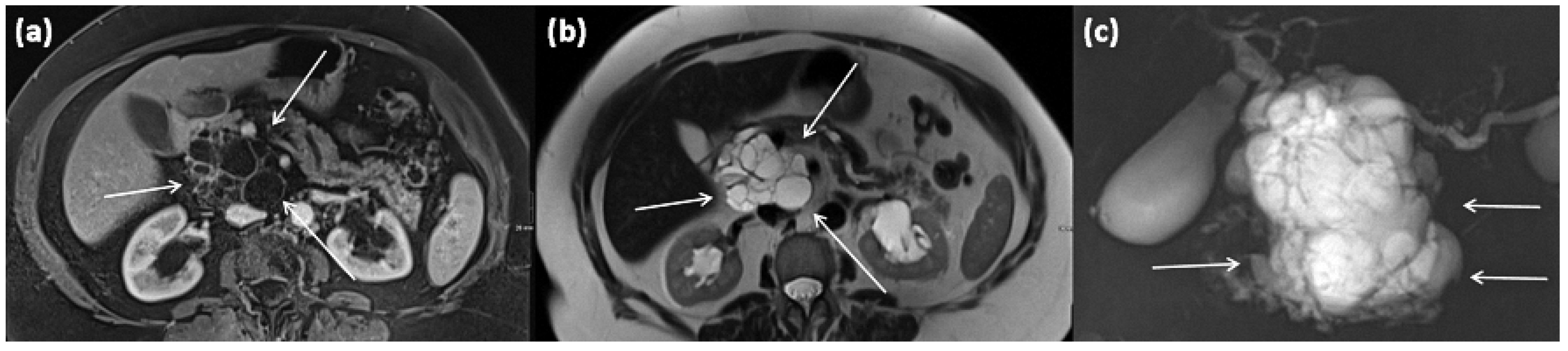 Diagnostics 13 00454 g019 Diagnostics 13 00454 g019