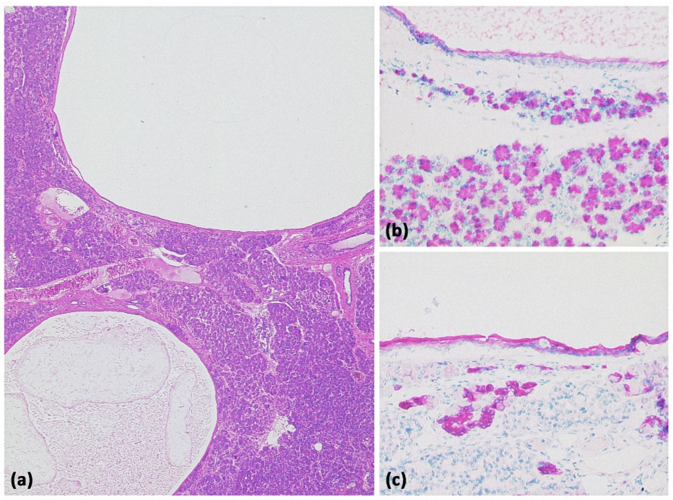 Diagnostics 13 00454 g021 Diagnostics 13 00454 g021