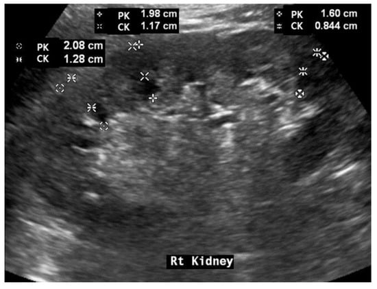 在庫有り お買い得 Atlas of Renal Ultrasonography 希少 腎臓