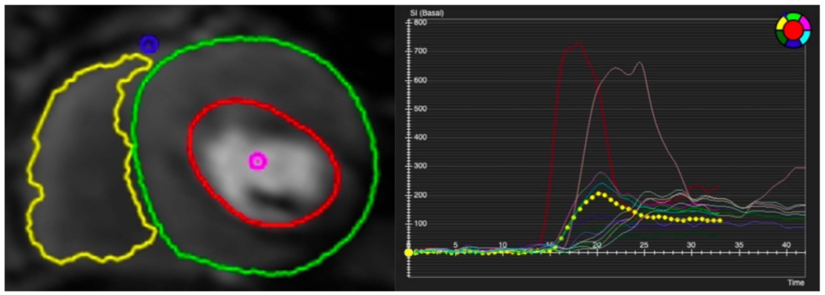 Diagnostics 13 00524 g005 Diagnostics 13 00524 g005