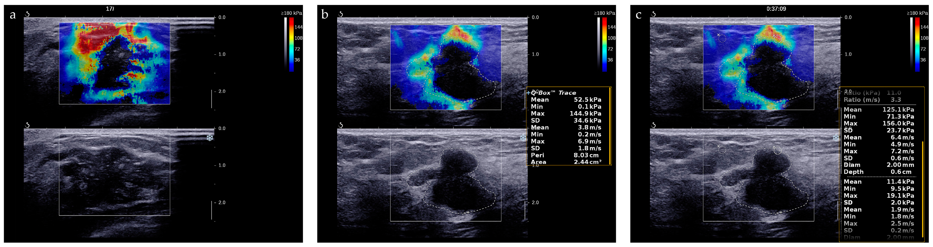 Diagnostics 13 00540 g004 Diagnostics 13 00540 g004