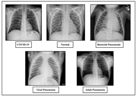 Diagnostics | Free Full-Text | DTLCx: An Improved ResNet Architecture ...