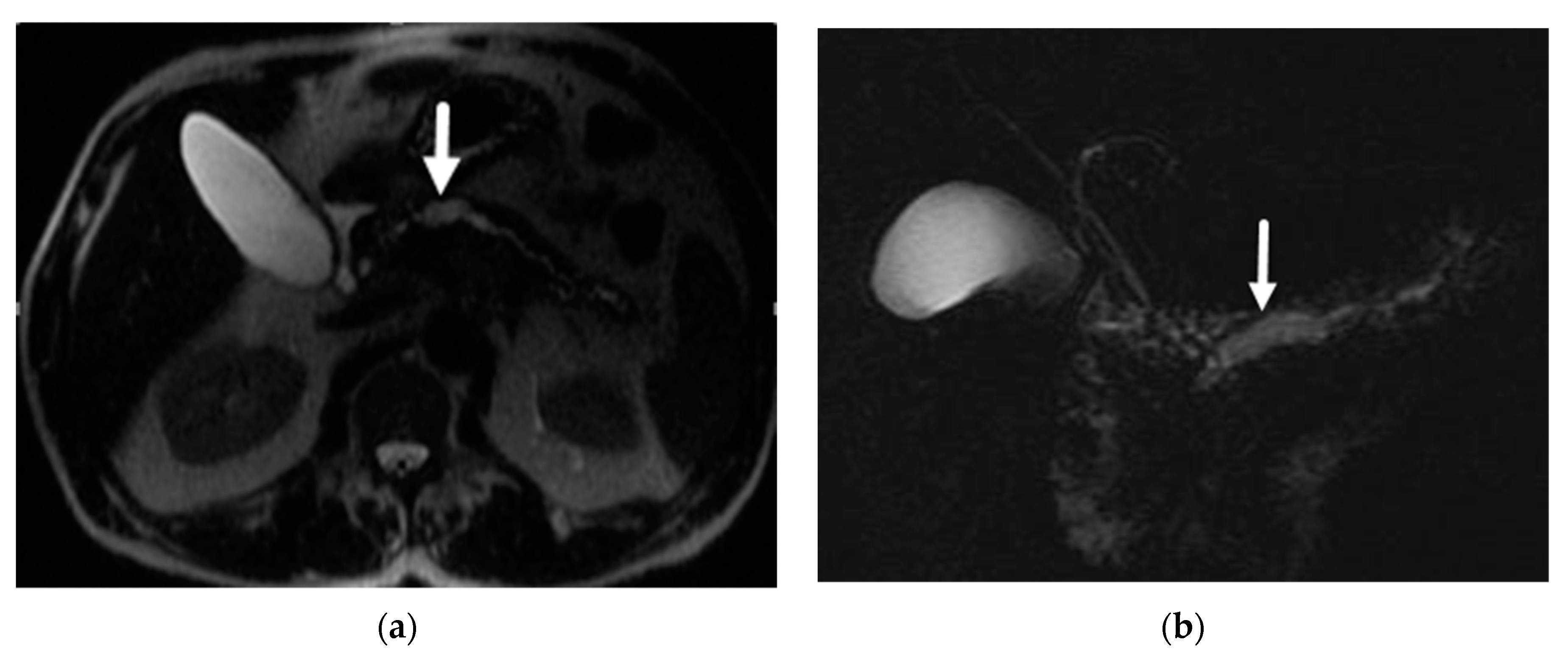 Diagnostics 13 00585 g002 Diagnostics 13 00585 g002