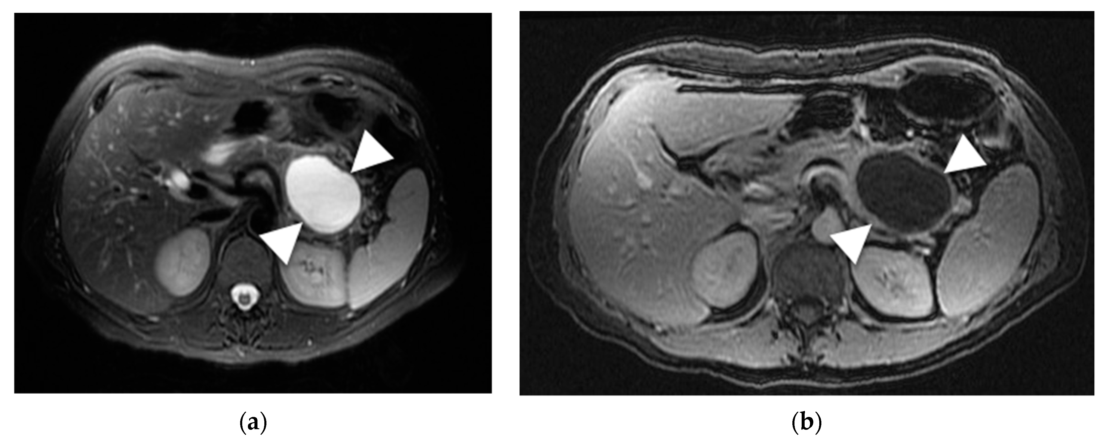 Diagnostics 13 00585 g003 Diagnostics 13 00585 g003
