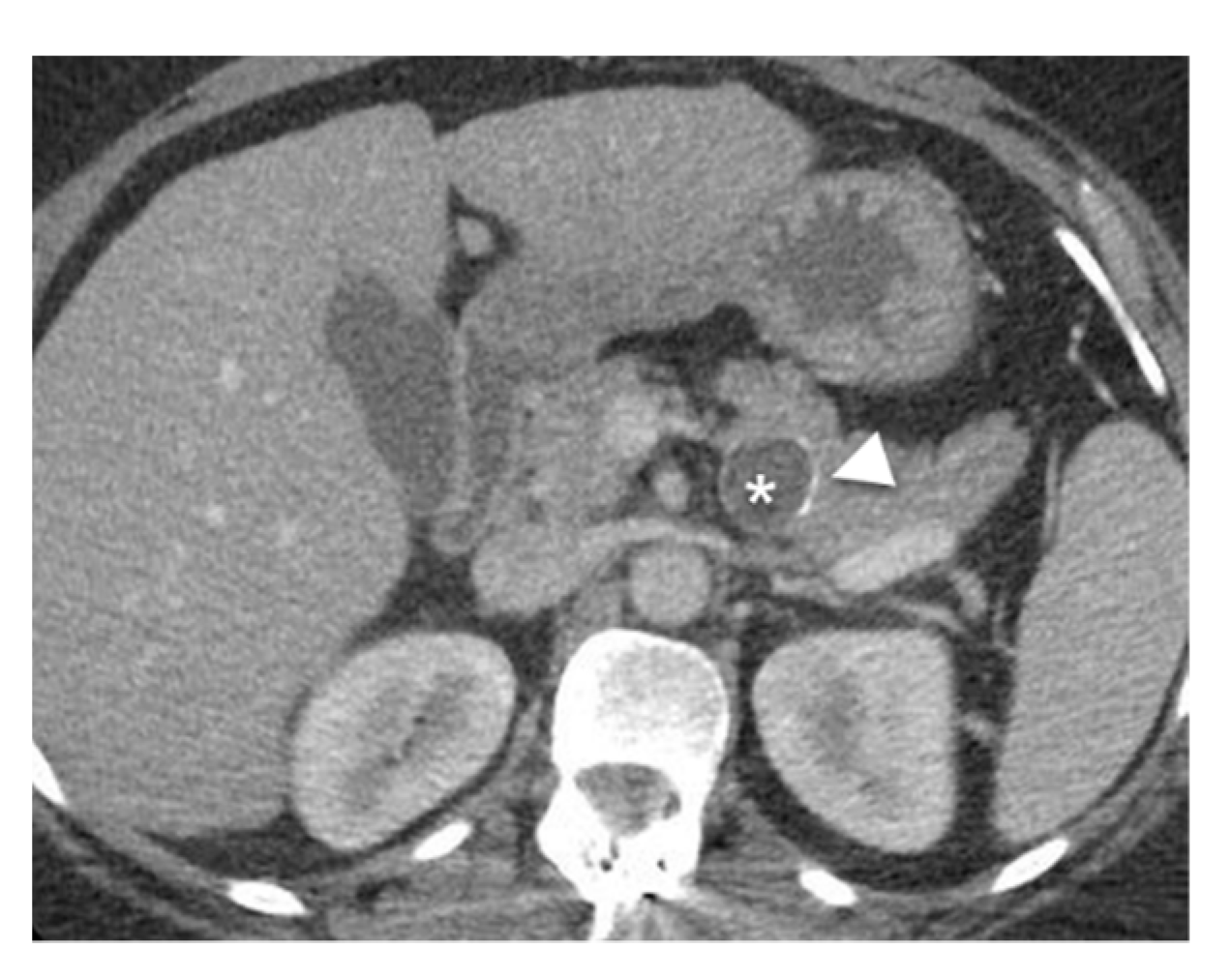 Diagnostics 13 00585 g004 Diagnostics 13 00585 g004