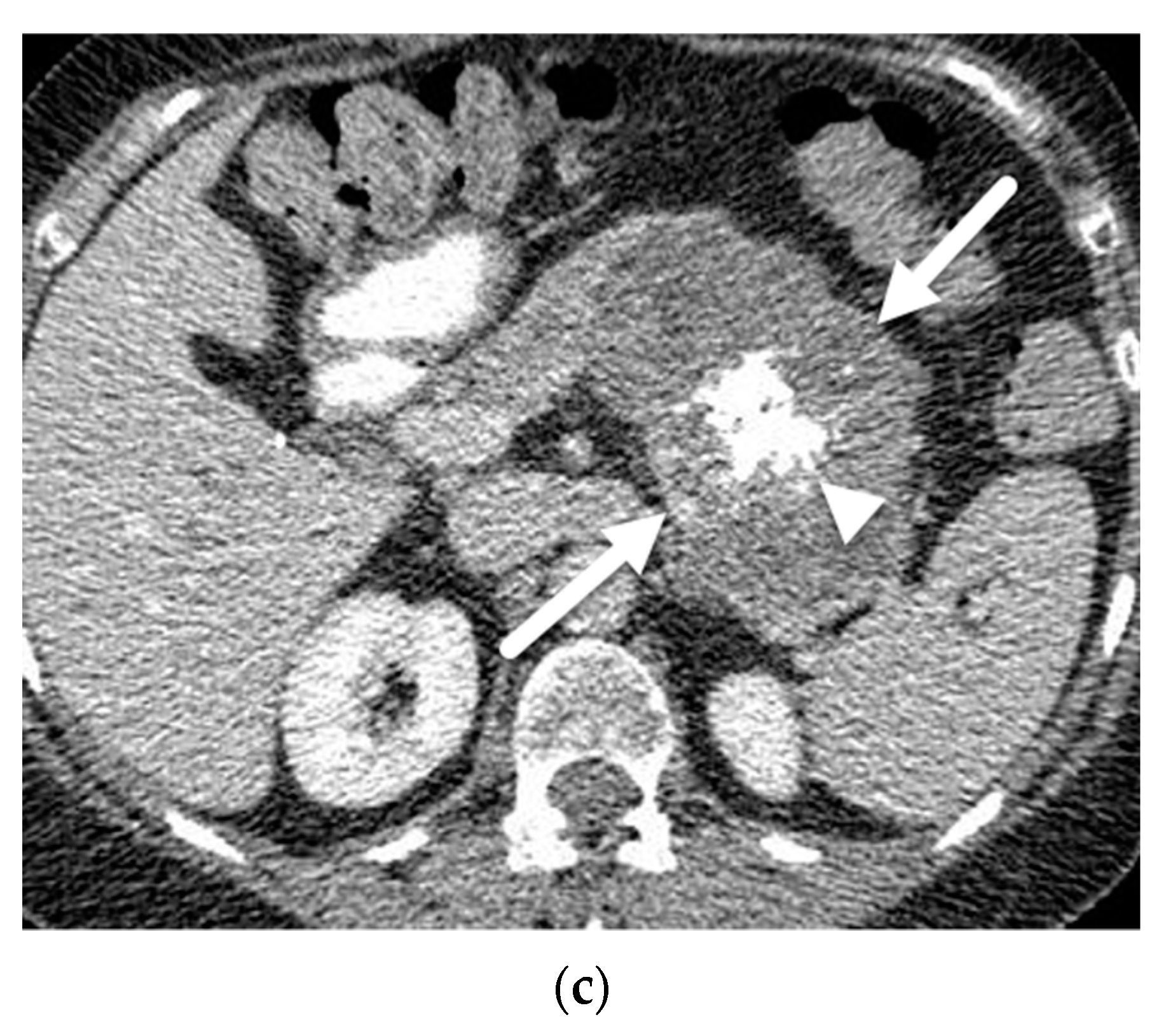 Diagnostics 13 00585 g005b Diagnostics 13 00585 g005b