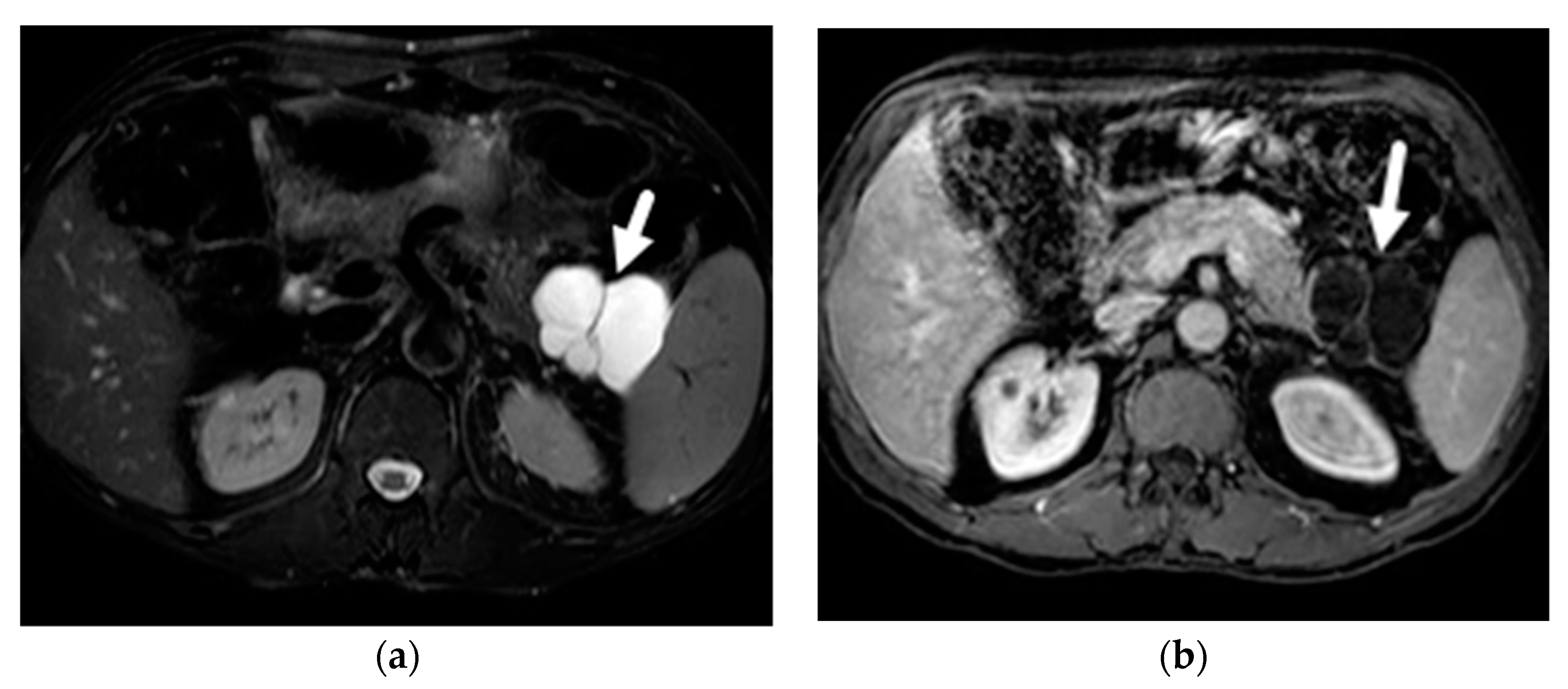 Diagnostics 13 00585 g006 Diagnostics 13 00585 g006