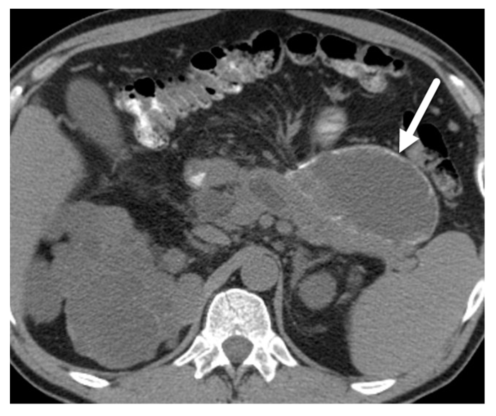 Diagnostics 13 00585 g007 Diagnostics 13 00585 g007