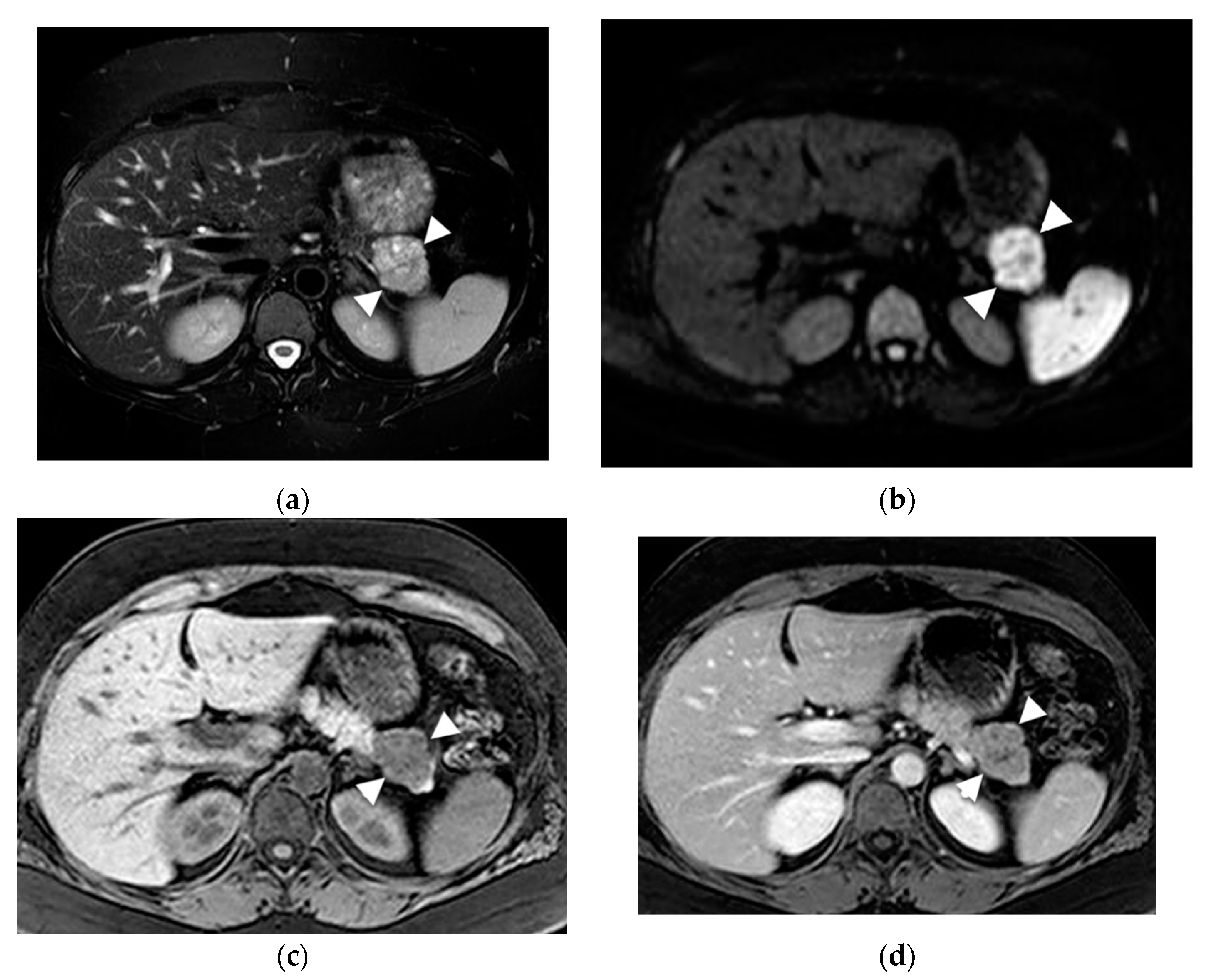 Diagnostics | Free Full-Text | The Role Of Magnetic Resonance Imaging ...