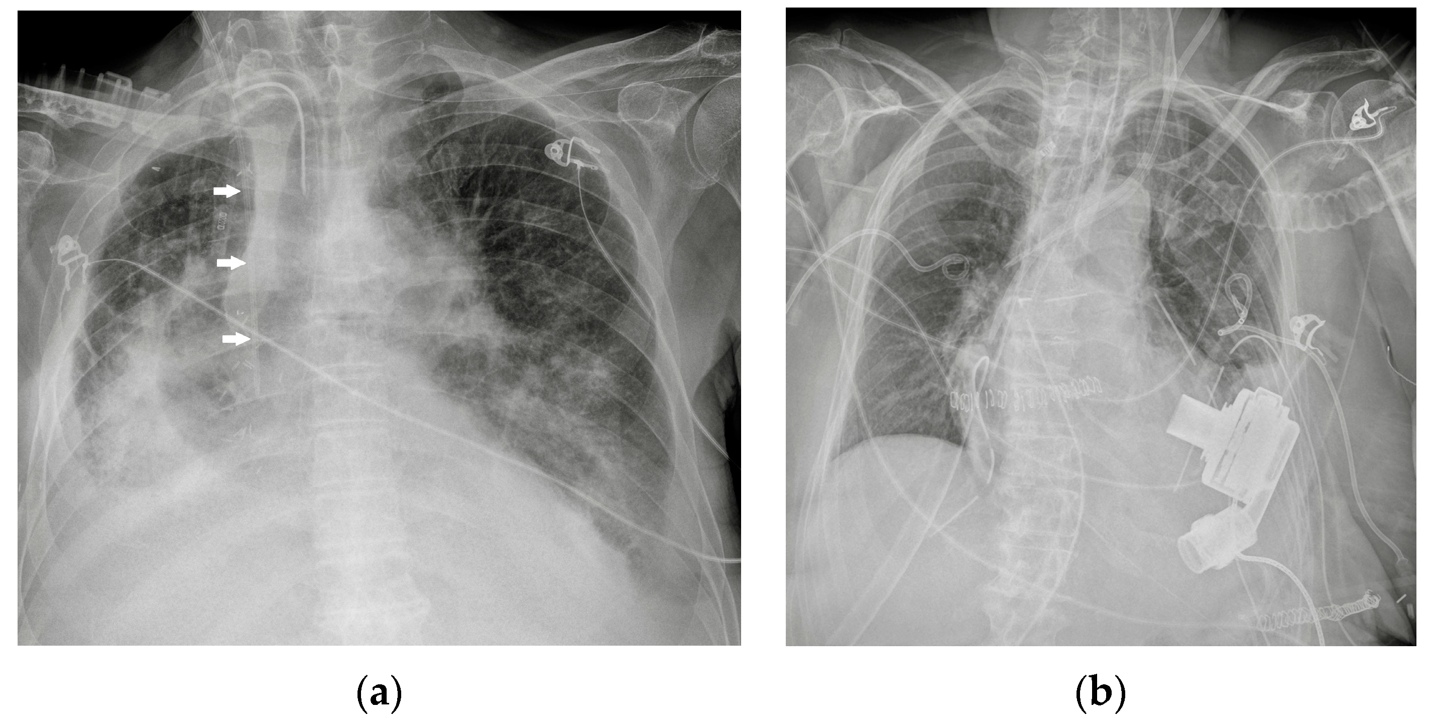 Female chest and abdominal muslces, pink x-ray frontal view