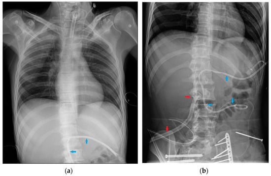 Small And Narrow Chest, Spot Diagnosis