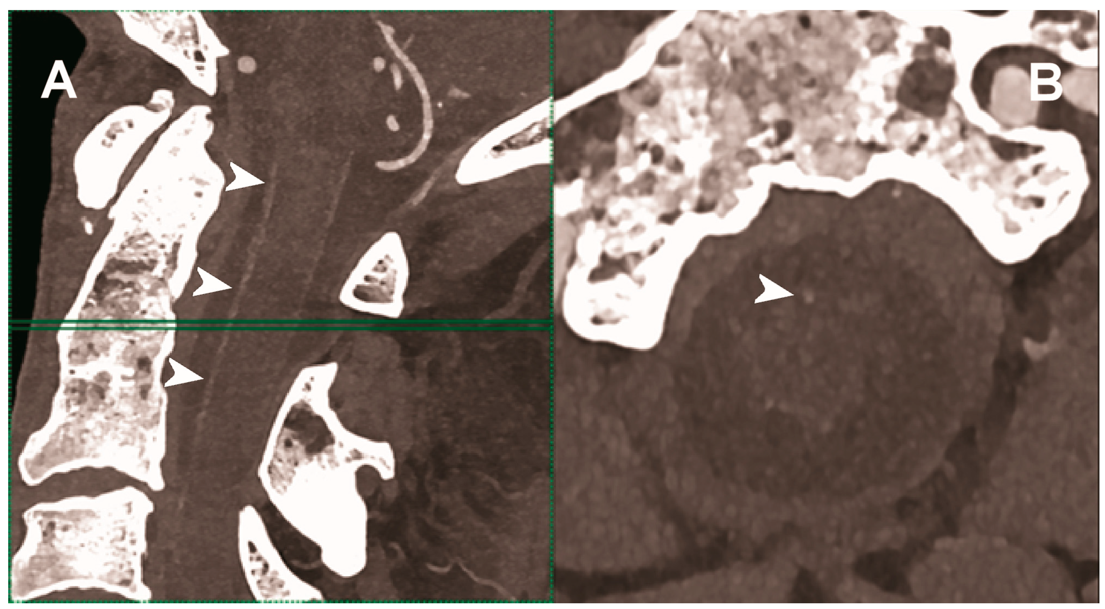 Diagnostics 13 00645 g005