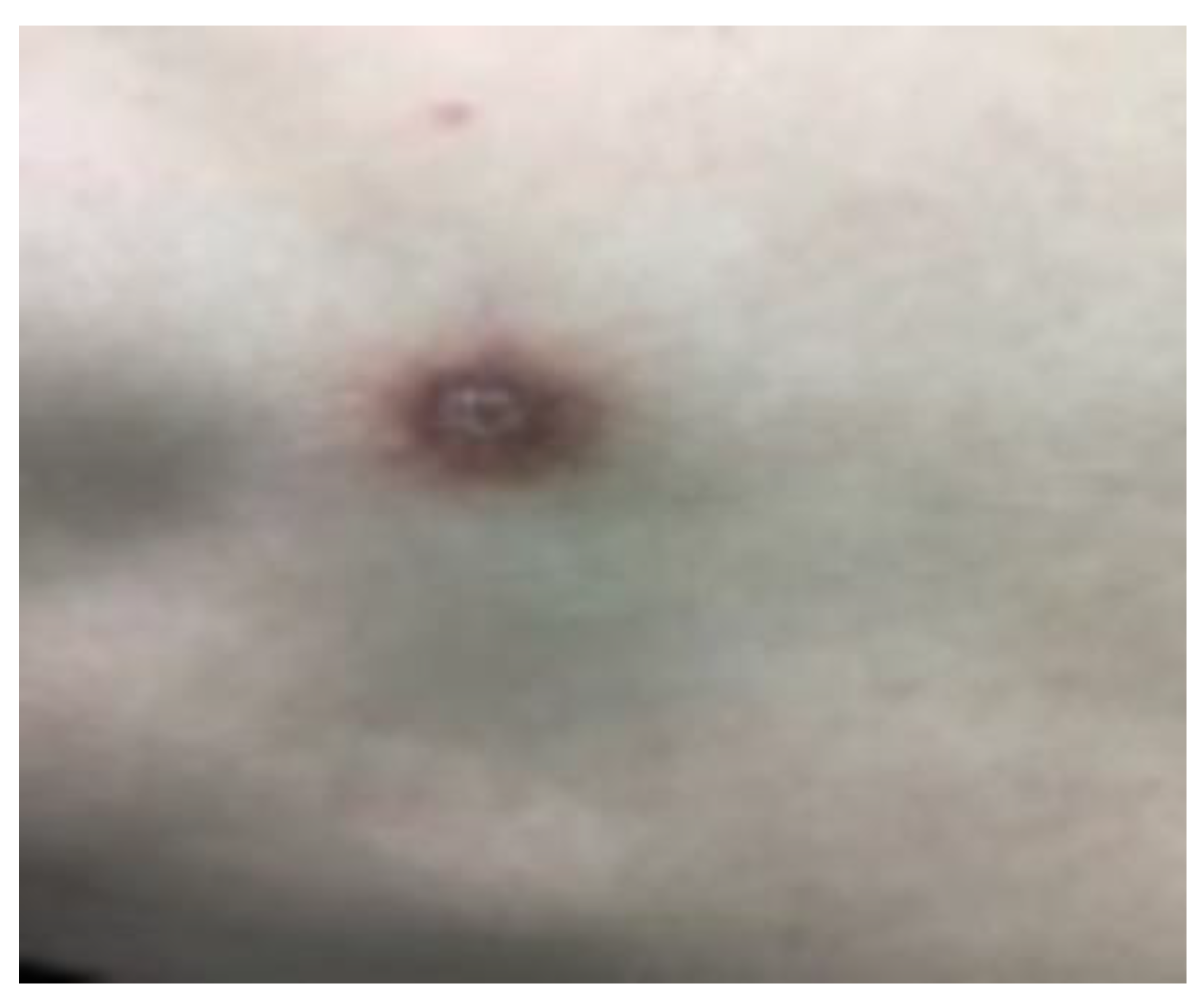 Diagnostics 13 00671 g002 Diagnostics 13 00671 g002