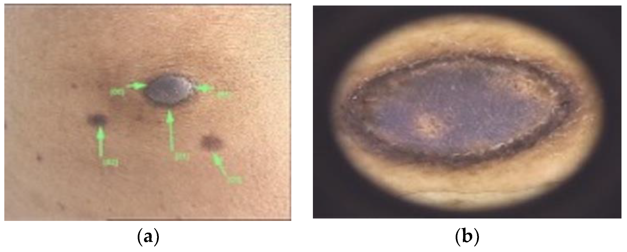 Diagnostics 13 00671 g004 Diagnostics 13 00671 g004