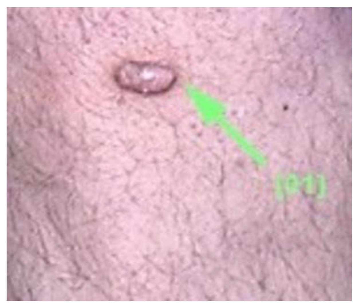 Diagnostics 13 00671 g005 Diagnostics 13 00671 g005