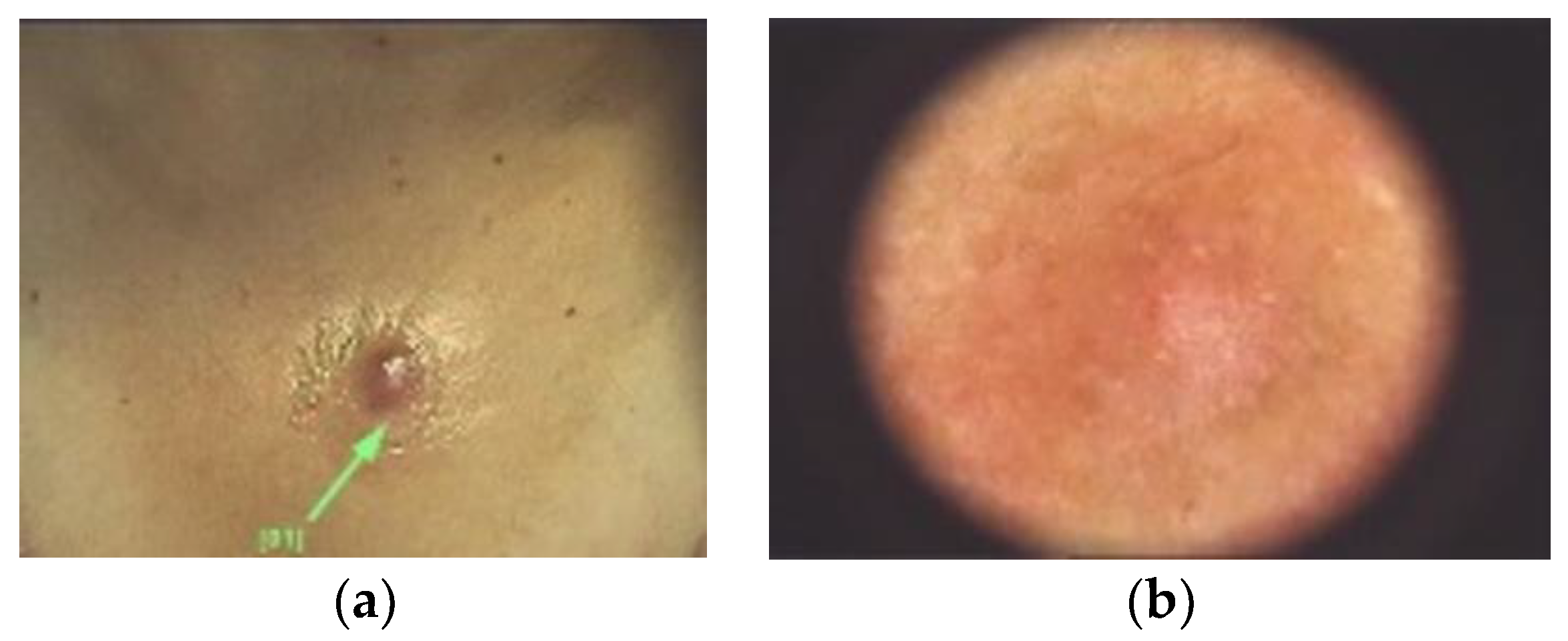 Diagnostics 13 00671 g011 Diagnostics 13 00671 g011