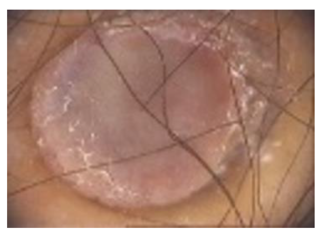 Diagnostics 13 00671 g012 Diagnostics 13 00671 g012