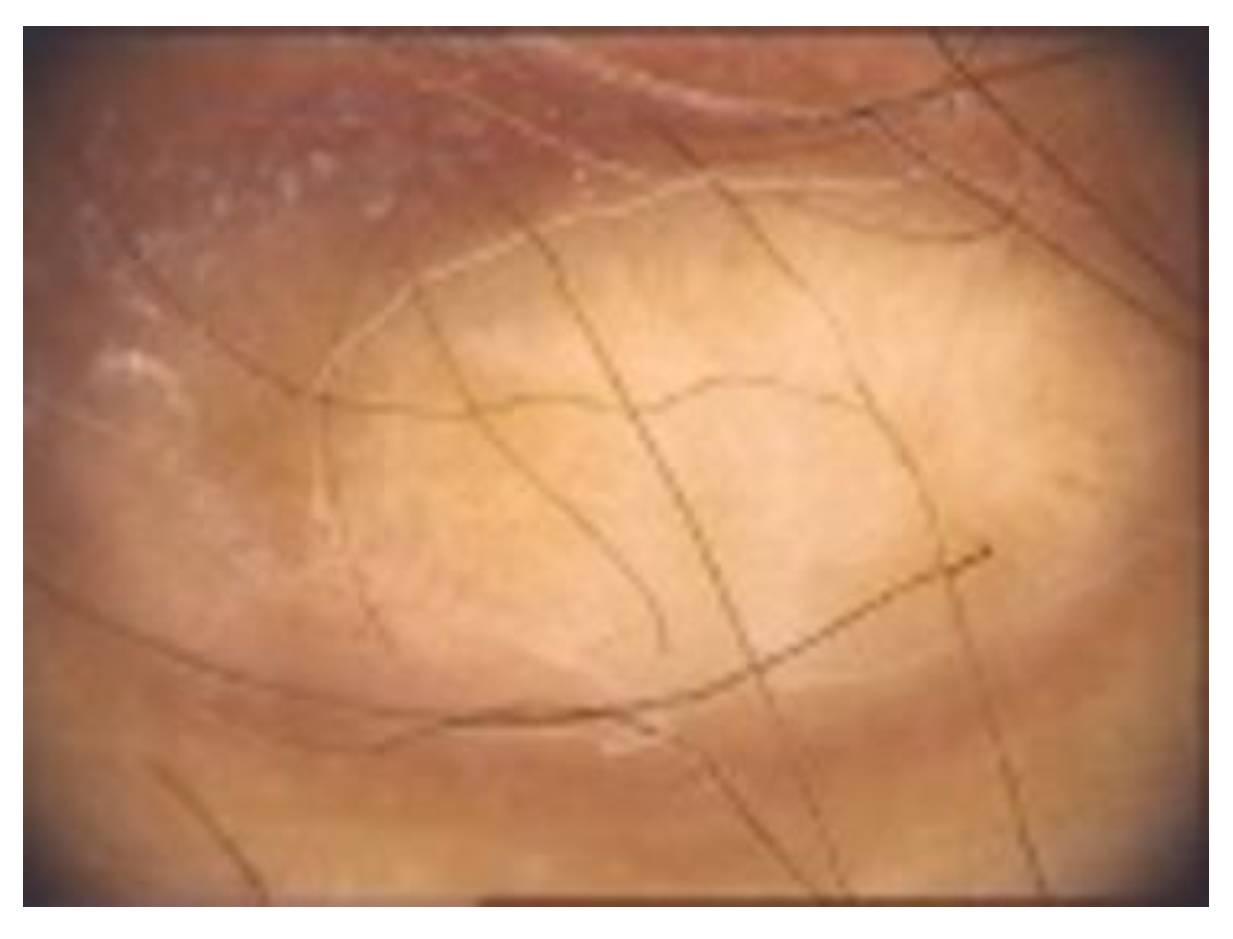 Diagnostics 13 00671 g013 Diagnostics 13 00671 g013