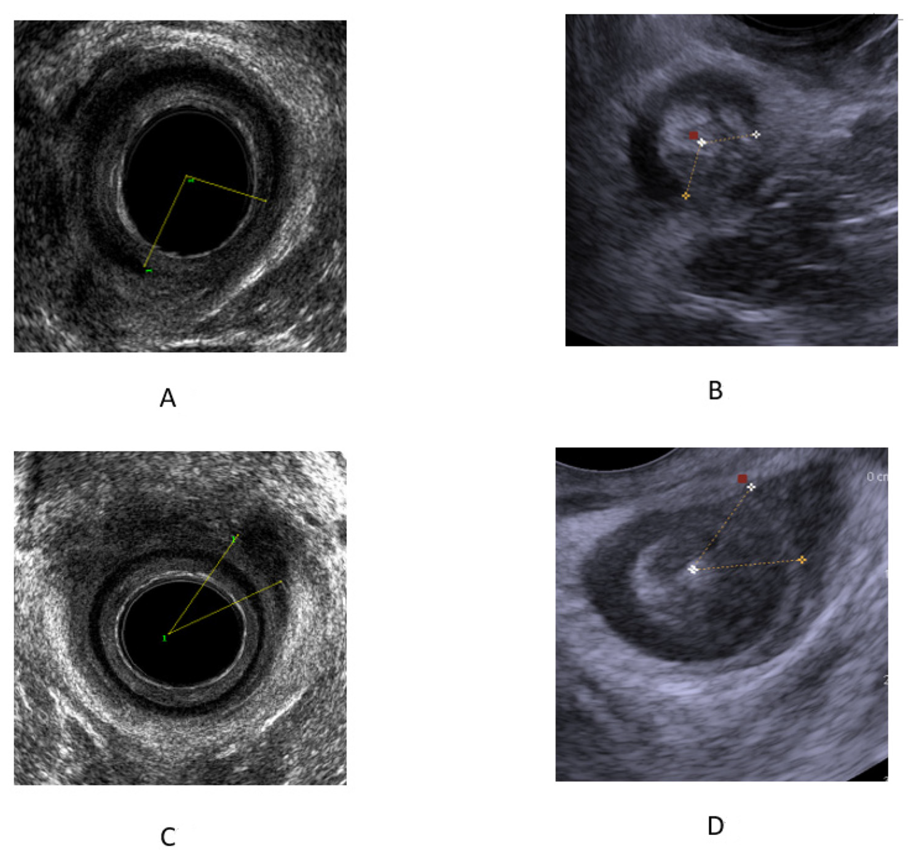 Diagnostics 13 00682 g002 Diagnostics 13 00682 g002