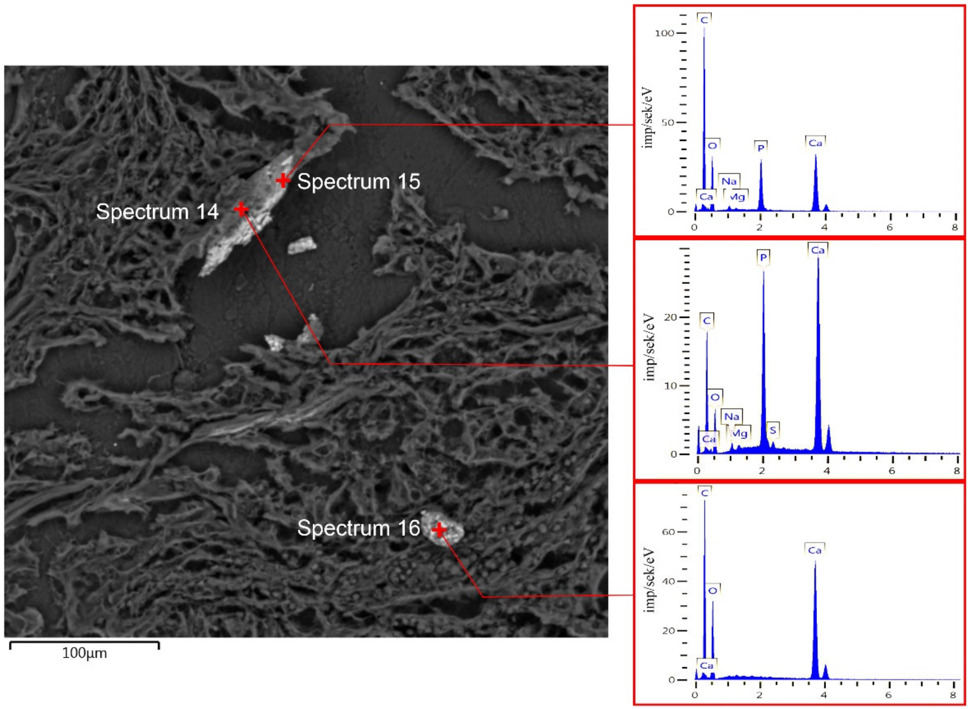 Diagnostics 13 00737 g006 Diagnostics 13 00737 g006