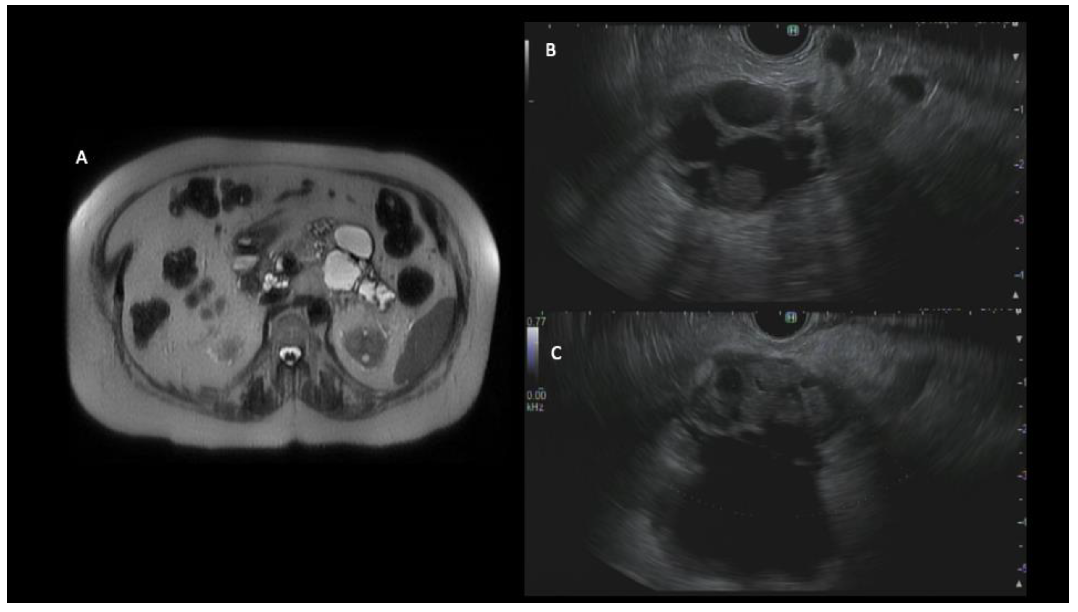 Diagnostics 13 00749 g002 Diagnostics 13 00749 g002