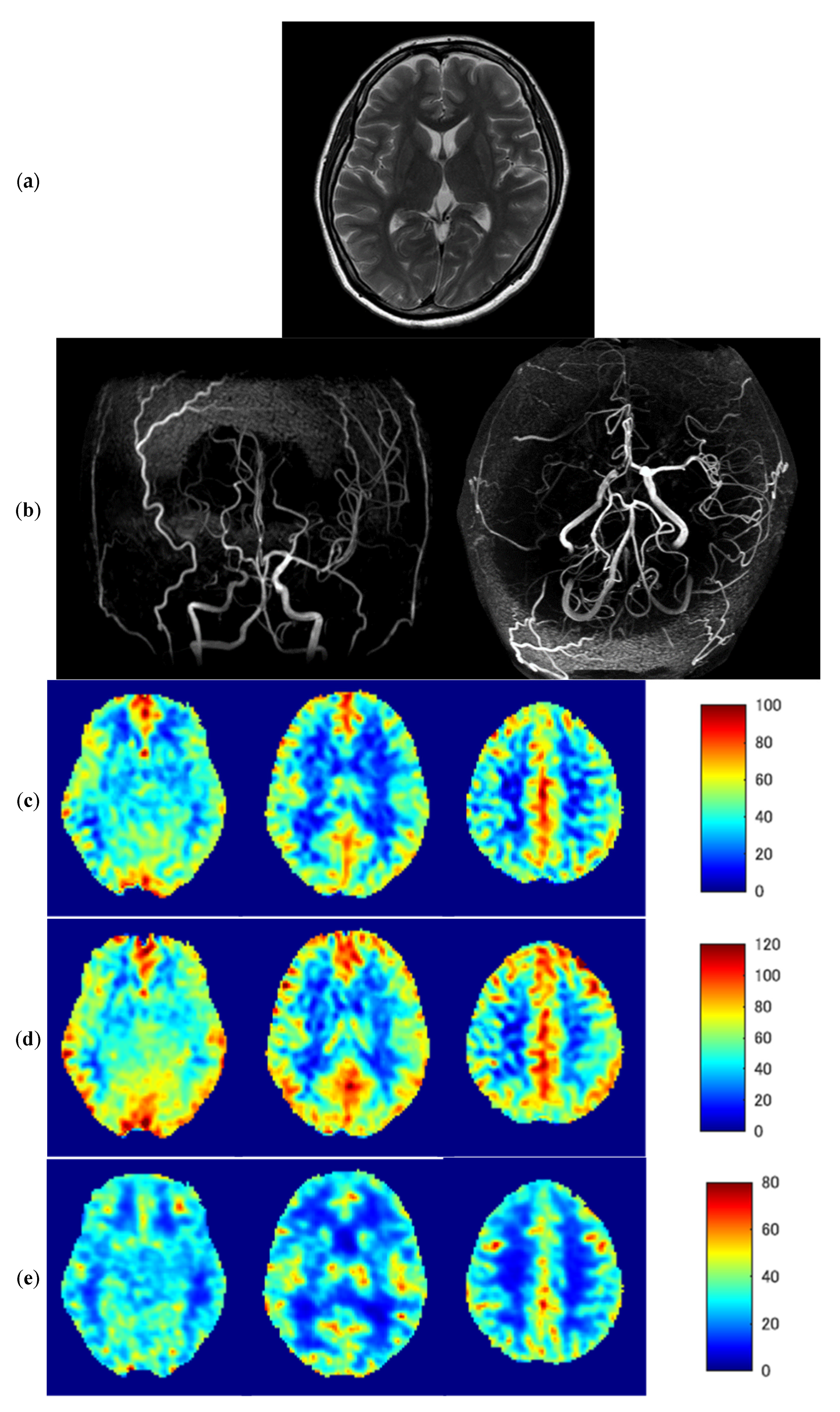 Diagnostics 13 00756 g005a Diagnostics 13 00756 g005a