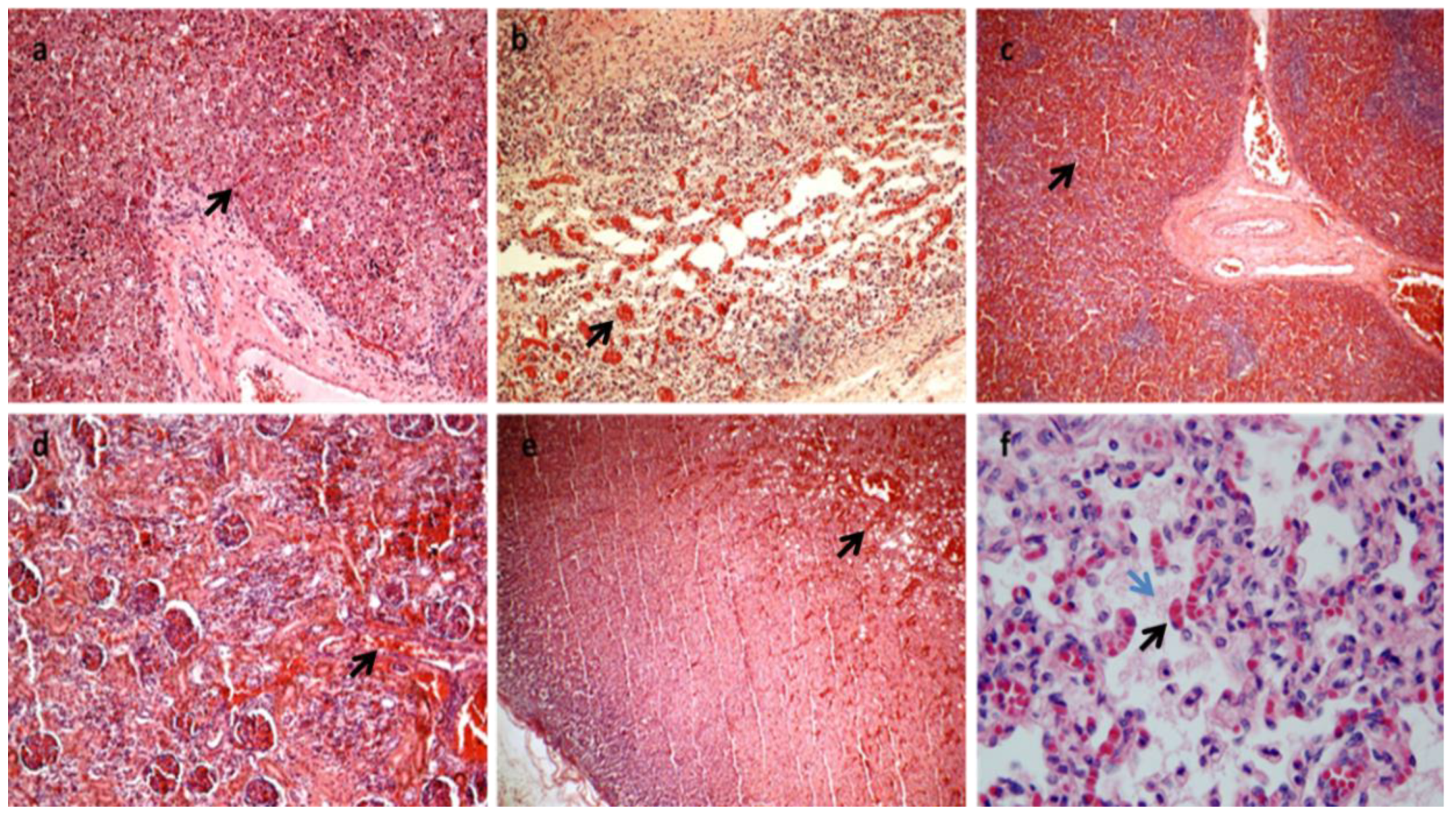 Diagnostics 13 00821 g002 Diagnostics 13 00821 g002