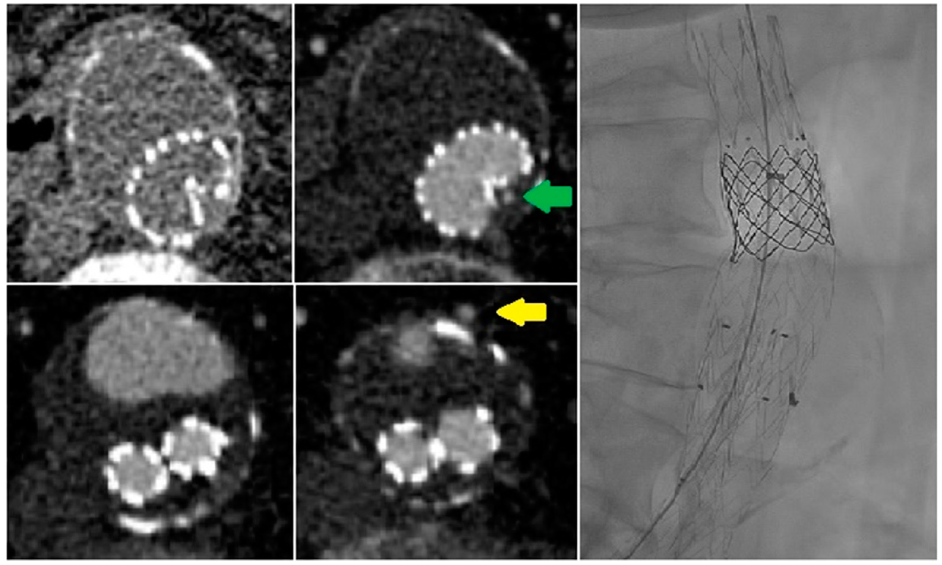 Diagnostics | Free Full-Text | Dynamic Computed Tomography Angiography ...