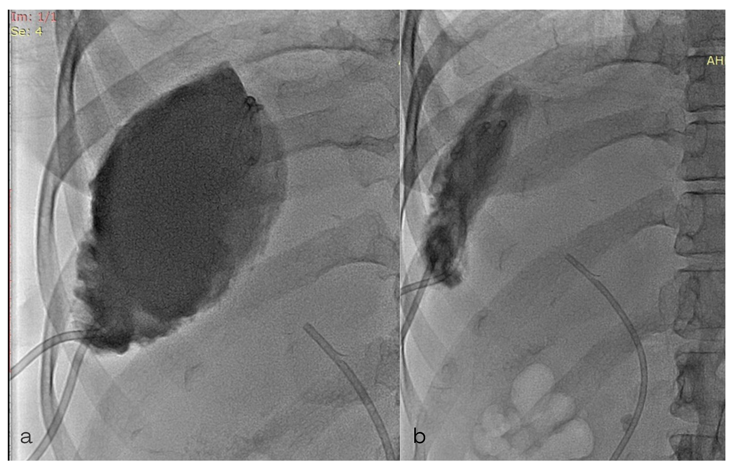 Diagnostics 13 00831 g005 Diagnostics 13 00831 g005