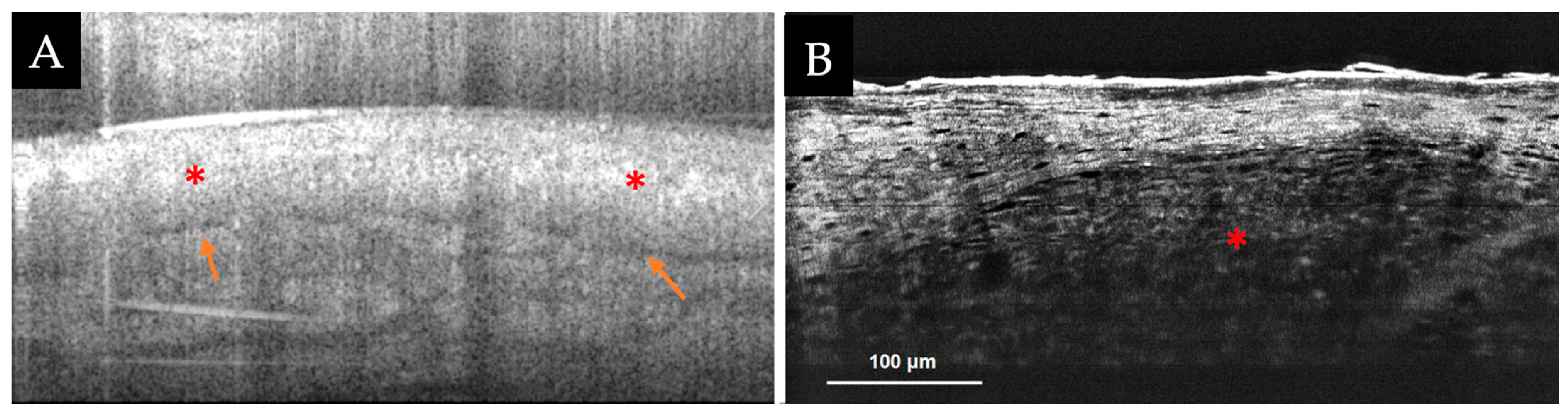 Diagnostics 13 00854 g003 Diagnostics 13 00854 g003