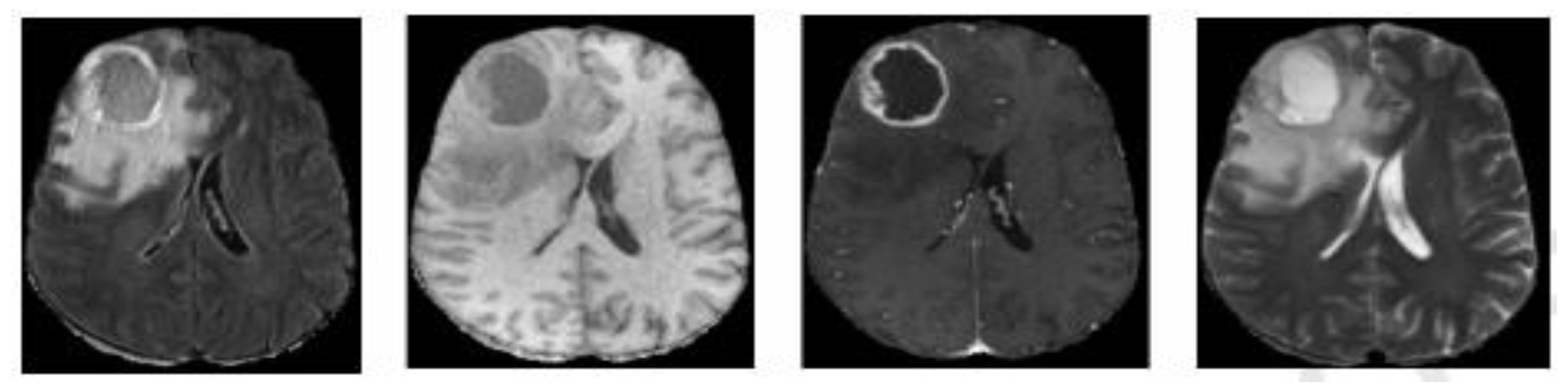 Diagnostics 13 00872 g001