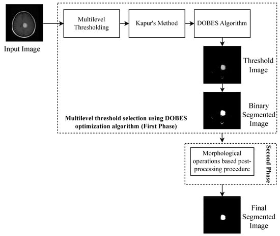 Diagnostics Free Full Text Hybrid Multilevel Thresholding Image