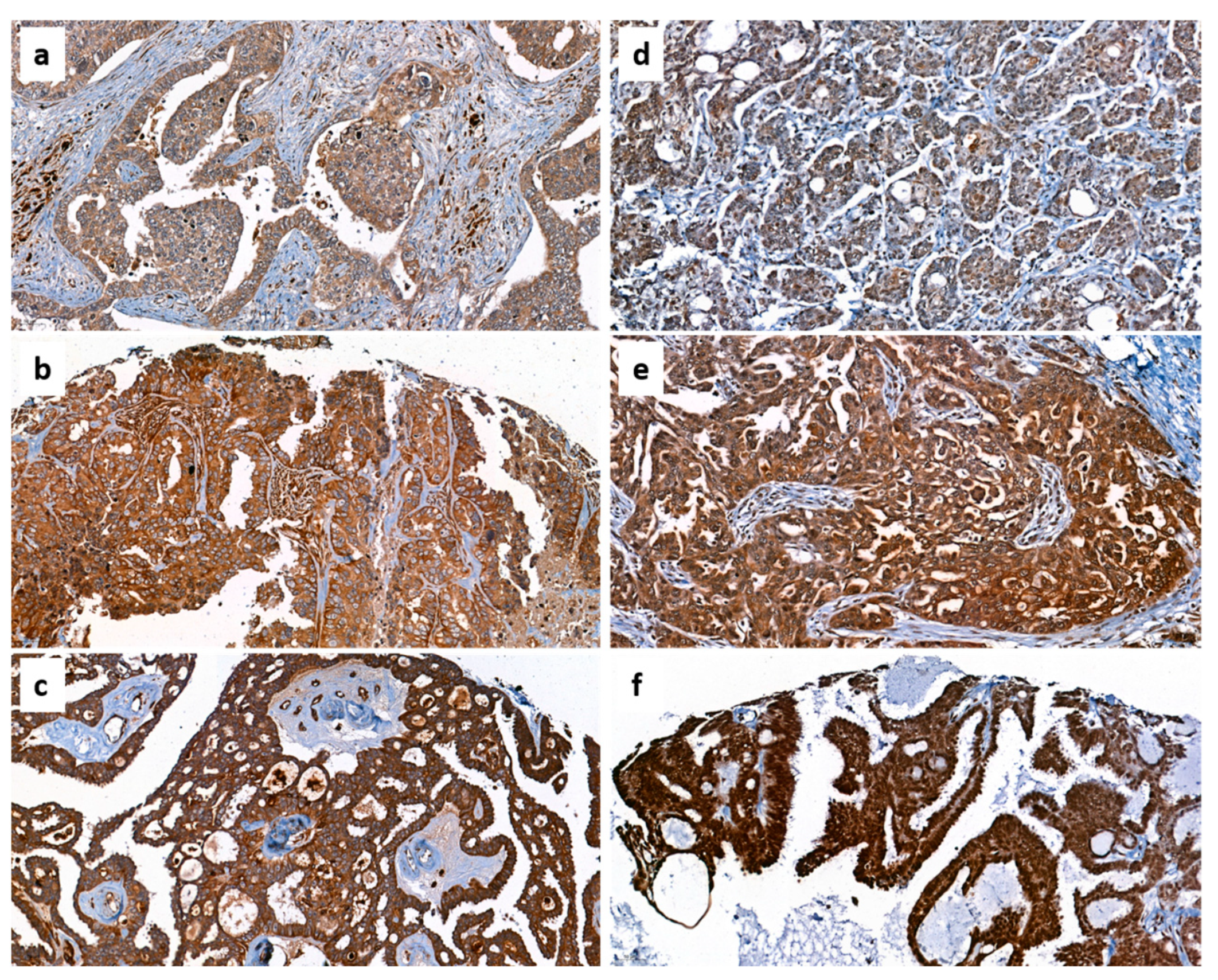 Diagnostics | Free Full-Text | Chemerin and Chemokine-like Receptor 1  Expression in Ovarian Cancer Associates with Proteins Involved in Estrogen  Signaling