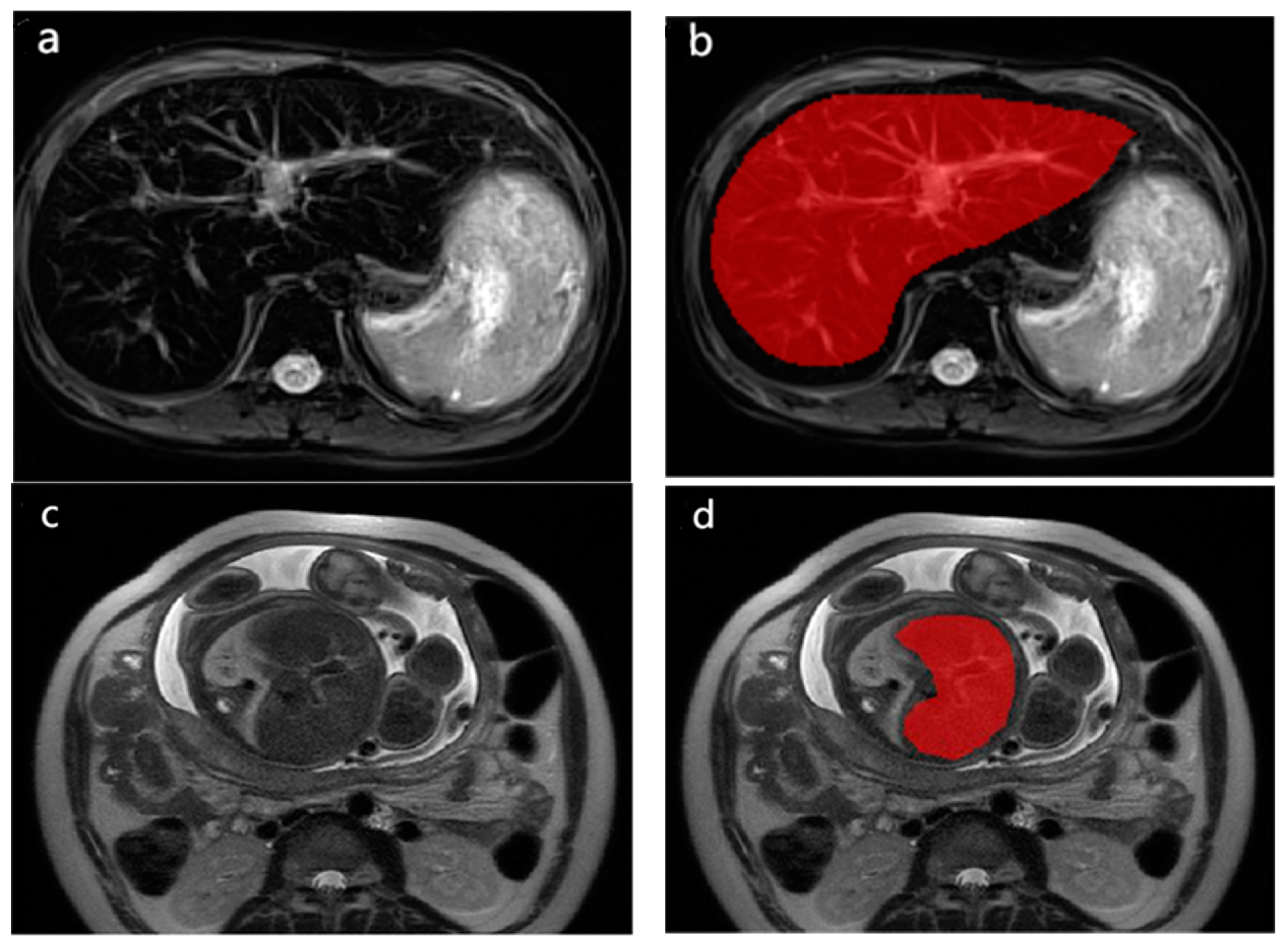 Diagnostics 13 00958 g0a1 Diagnostics 13 00958 g0a1