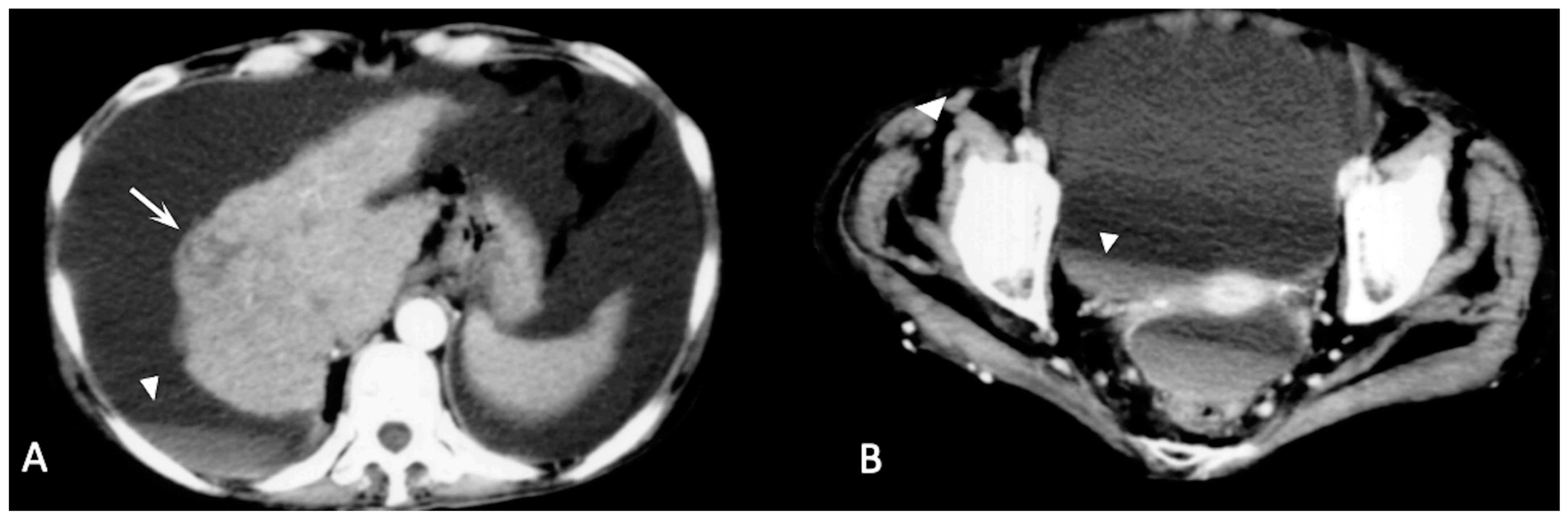 Diagnostics 13 01021 g005