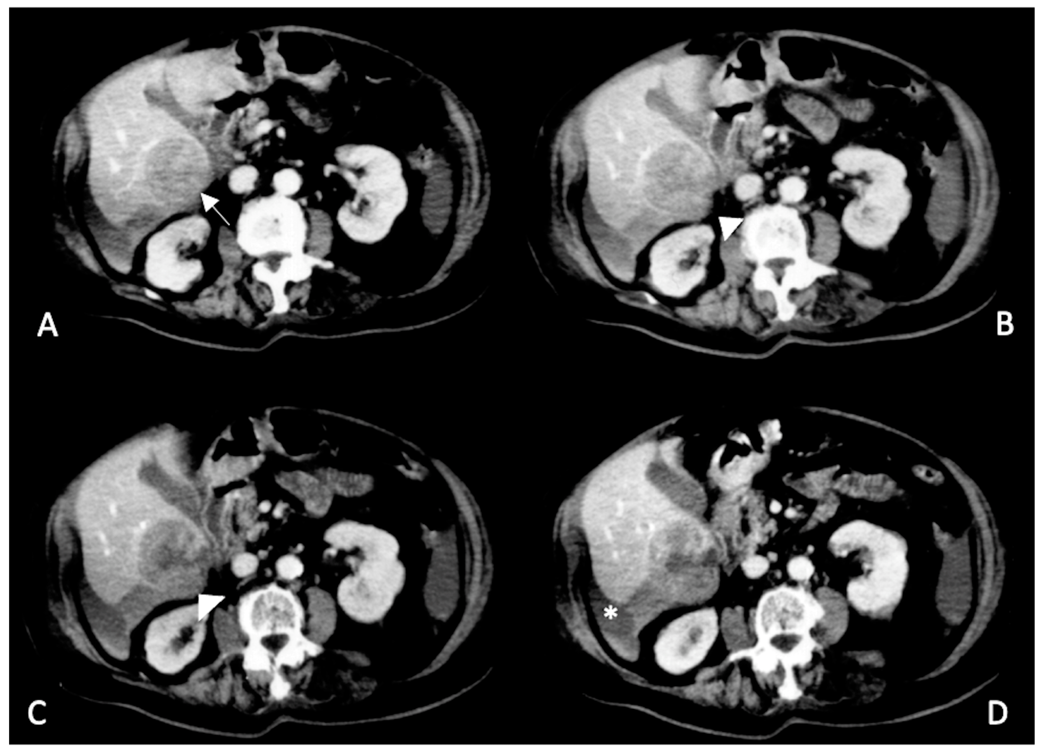 Diagnostics 13 01021 g006