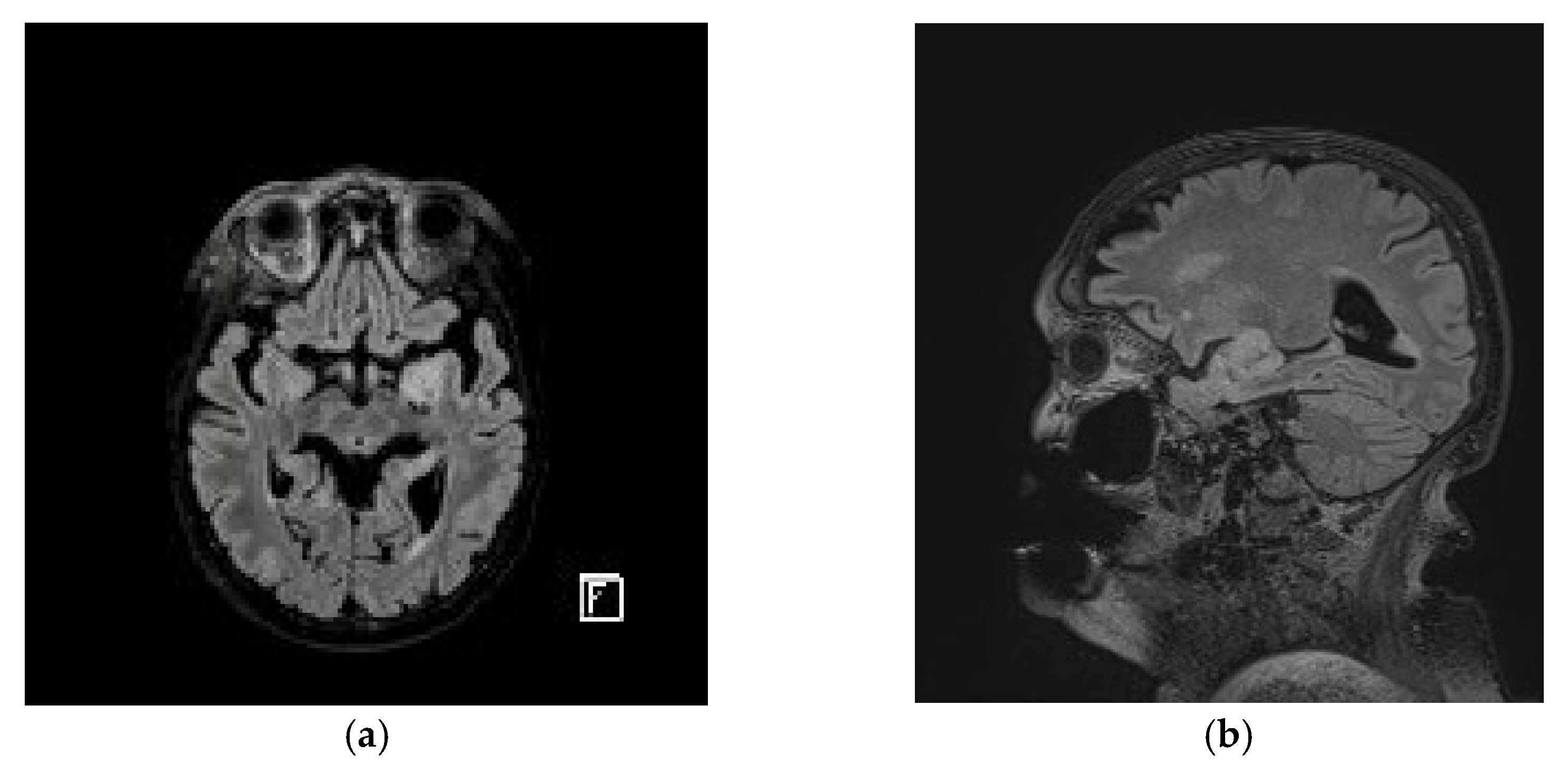 Diagnostics 13 01046 g008