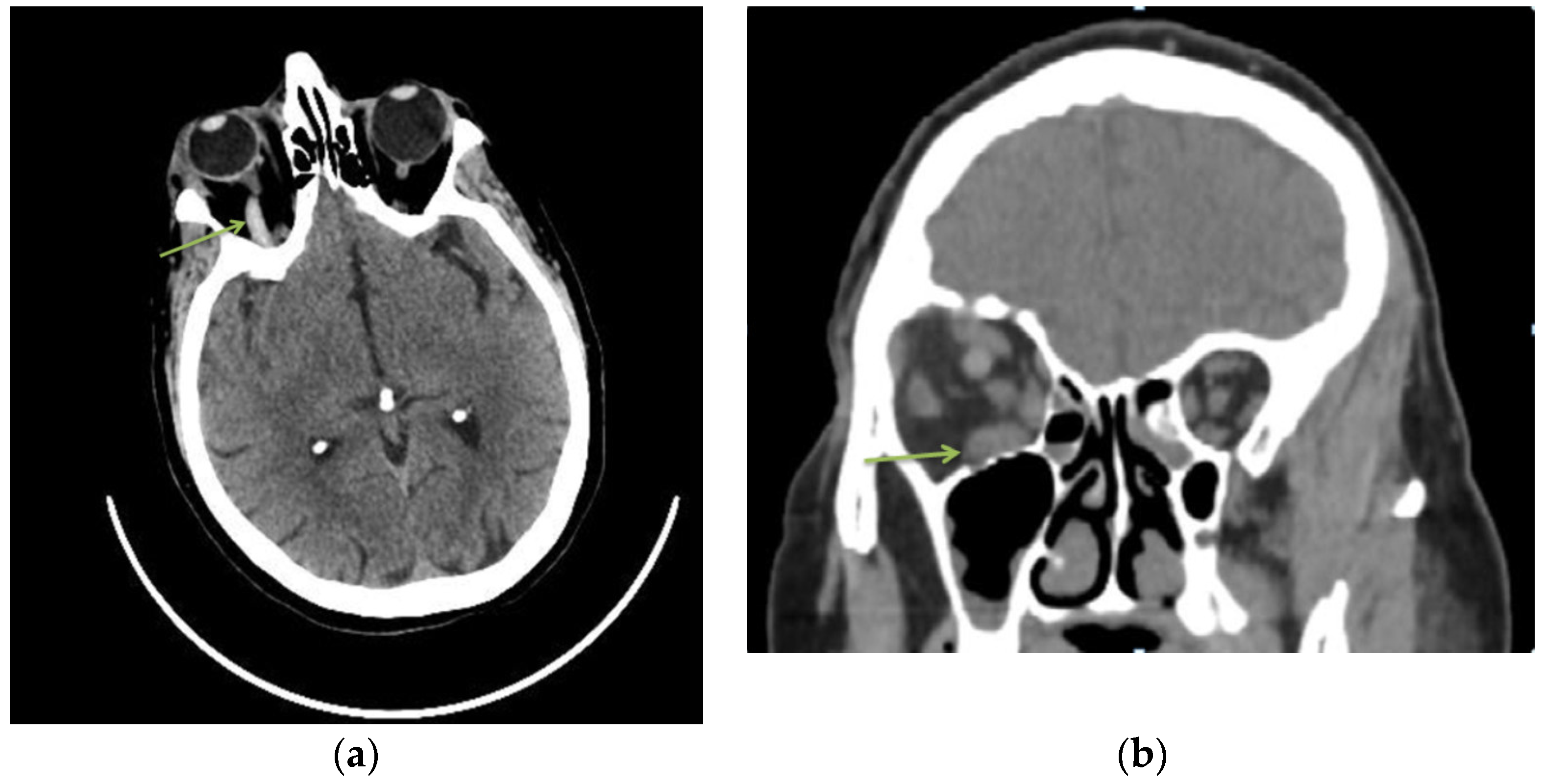 Diagnostics 13 01052 g001 Diagnostics 13 01052 g001