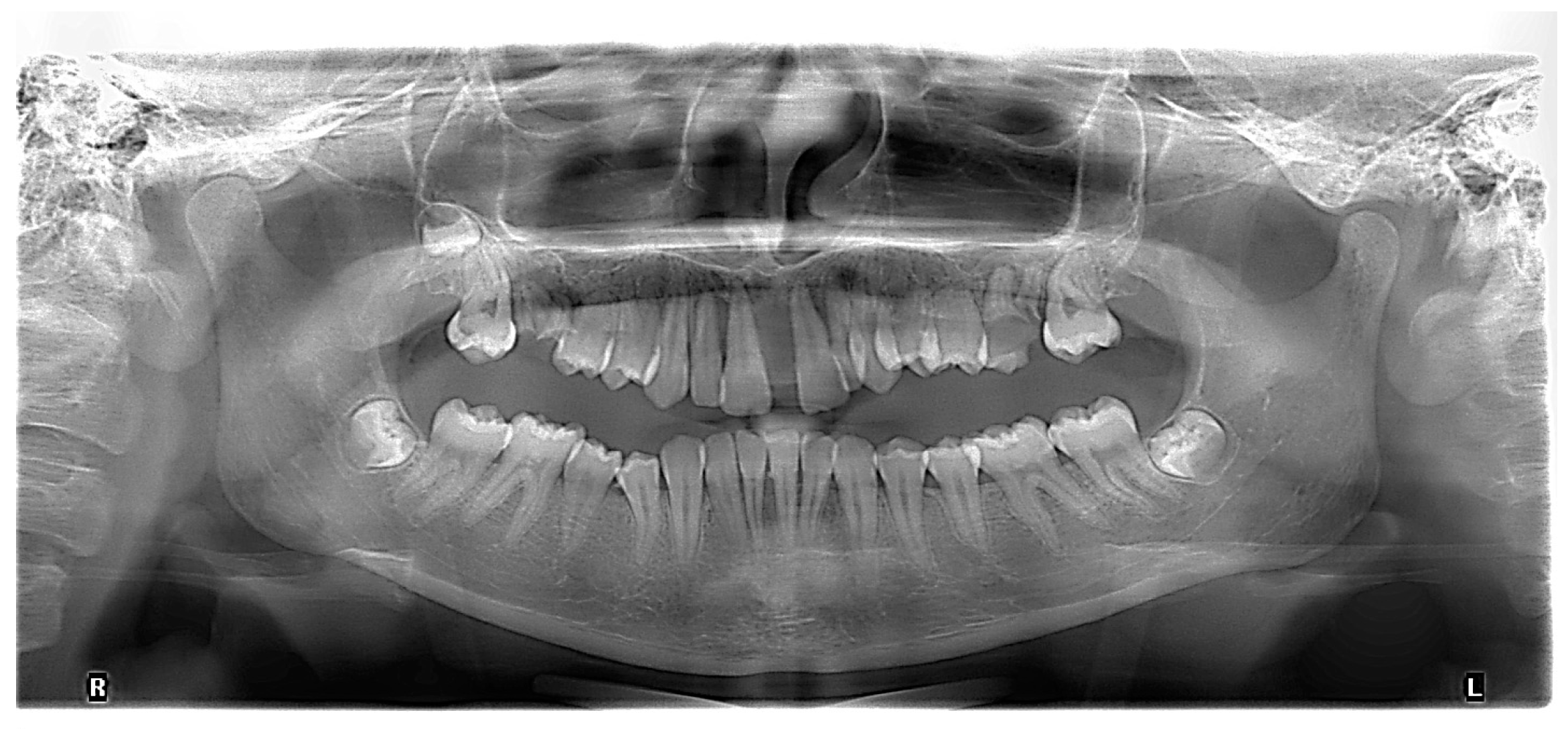 Diagnostics 13 01077 g003 Diagnostics 13 01077 g003