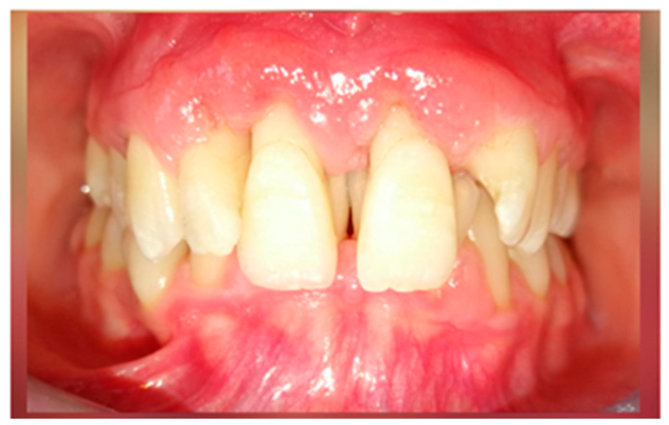 Diagnostics 13 01077 g005 Diagnostics 13 01077 g005