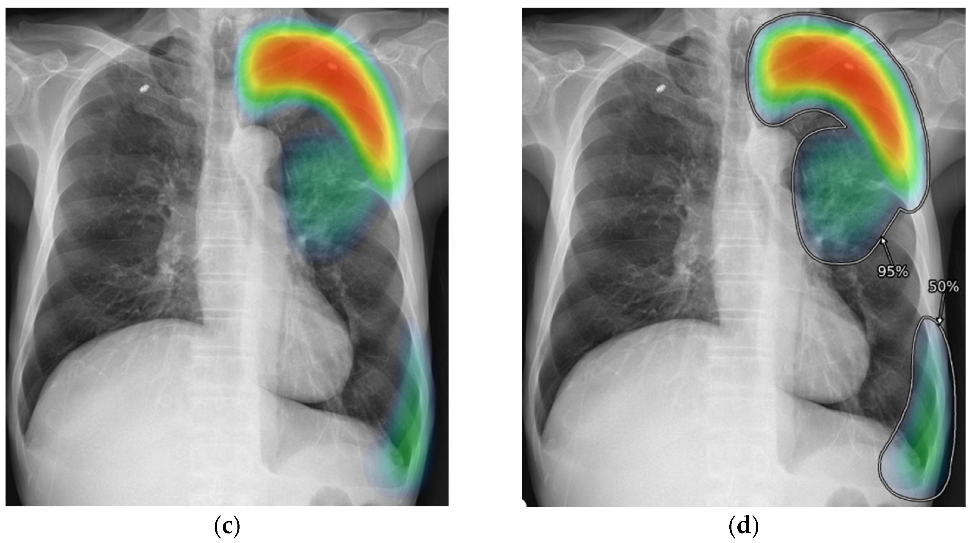 Diagnostics 13 01089 g001b