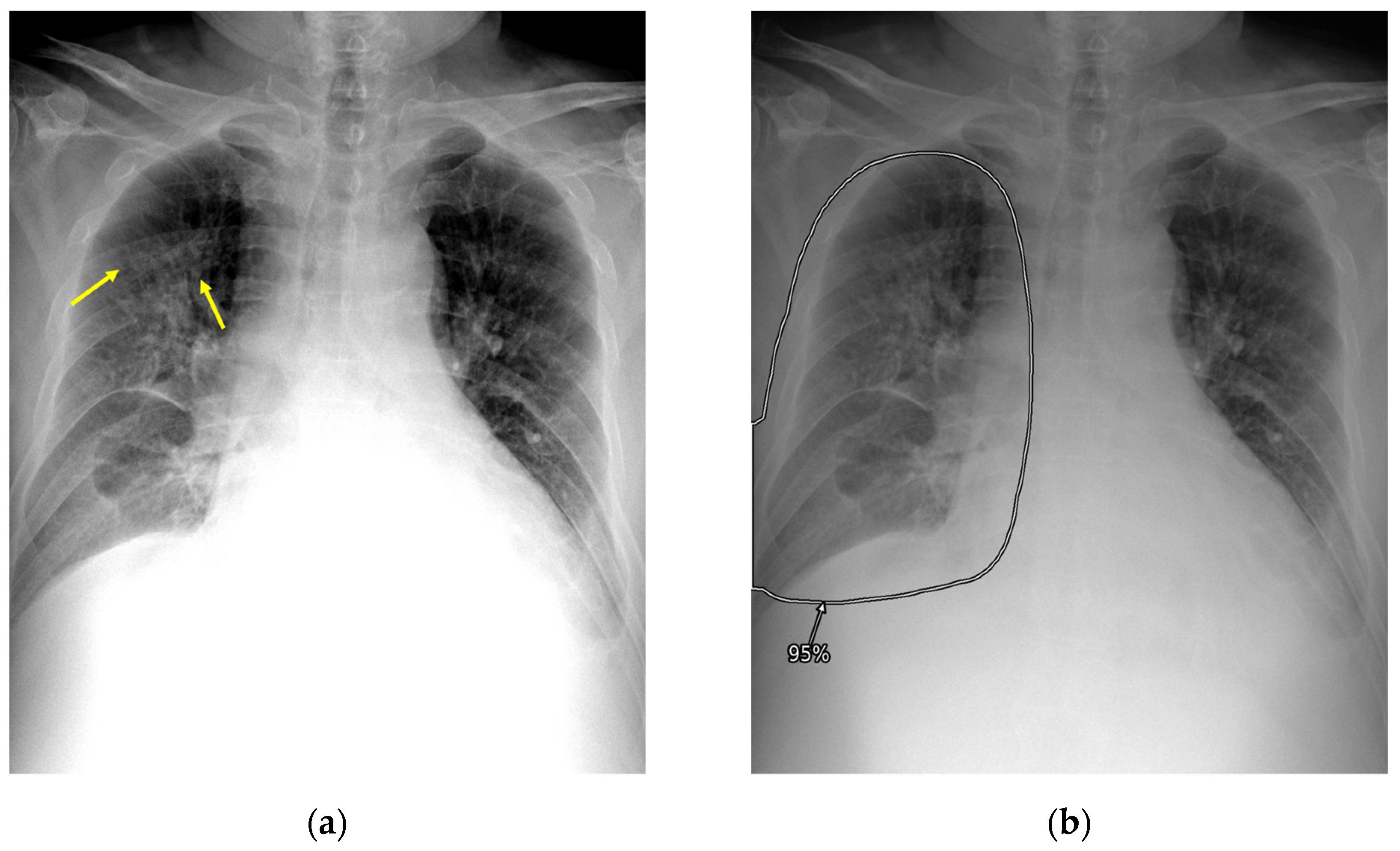 Diagnostics 13 01089 g002a