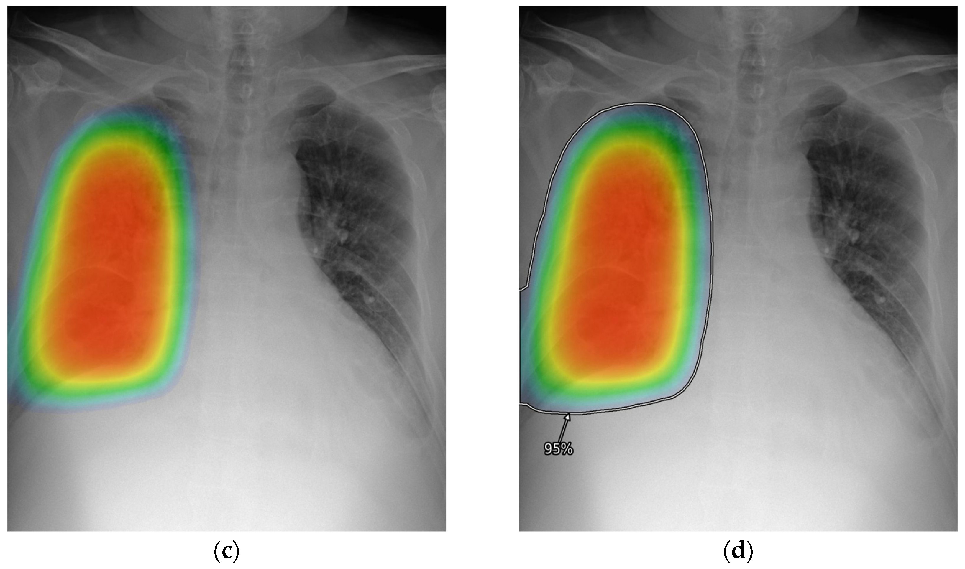 Diagnostics 13 01089 g002b