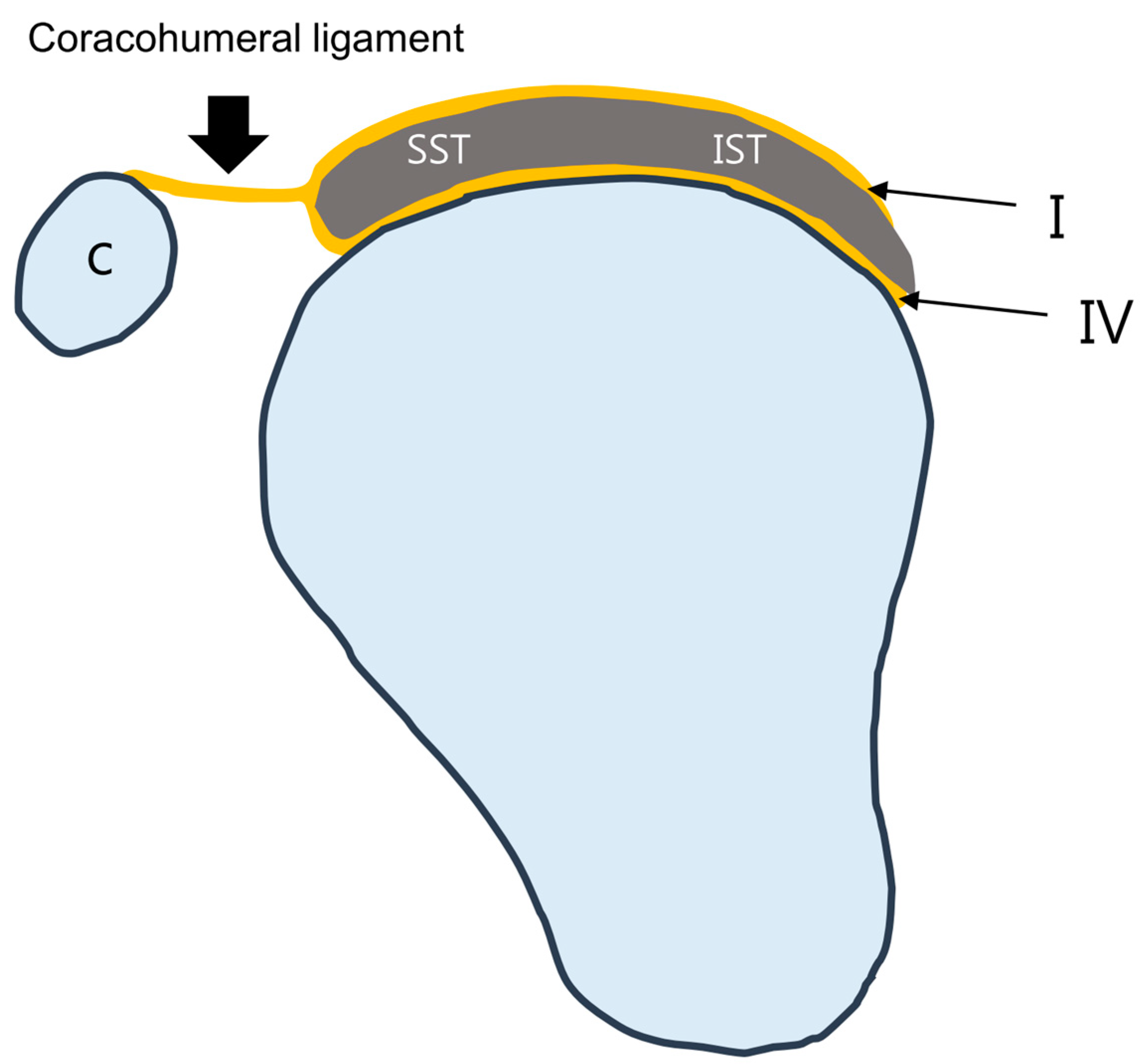 Coracohumeral Ligament