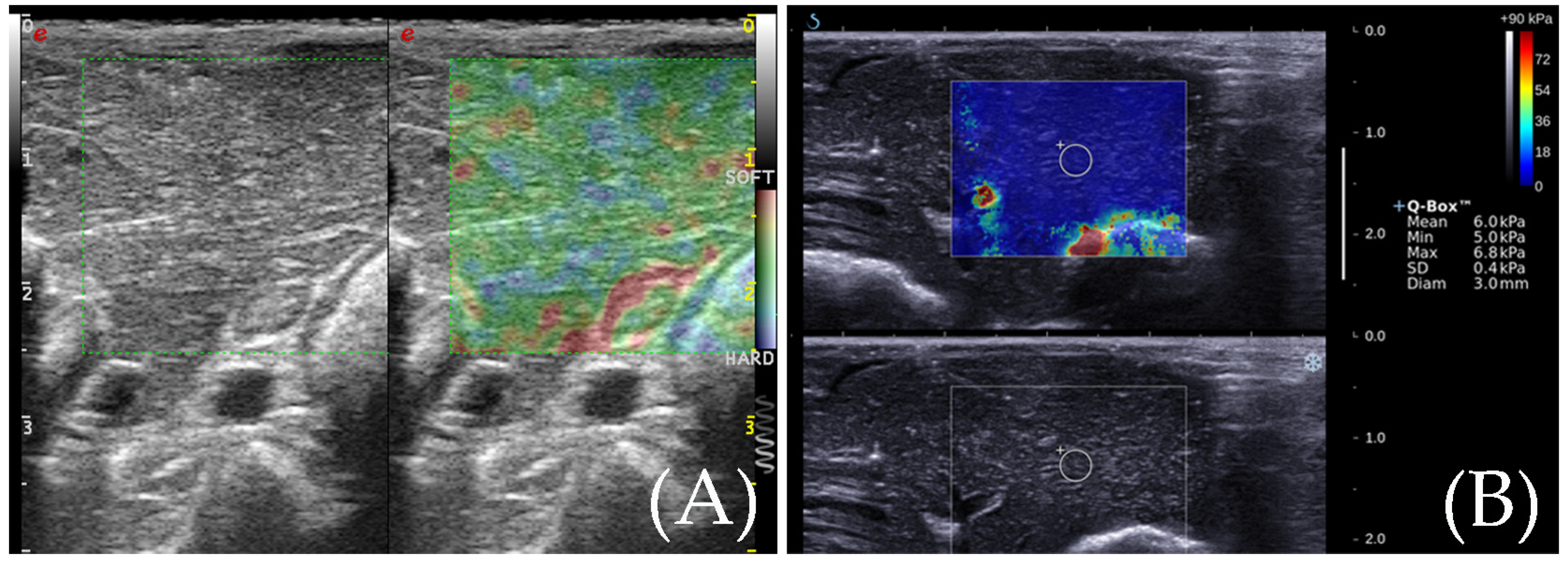 Diagnostics 13 01145 g002 Diagnostics 13 01145 g002