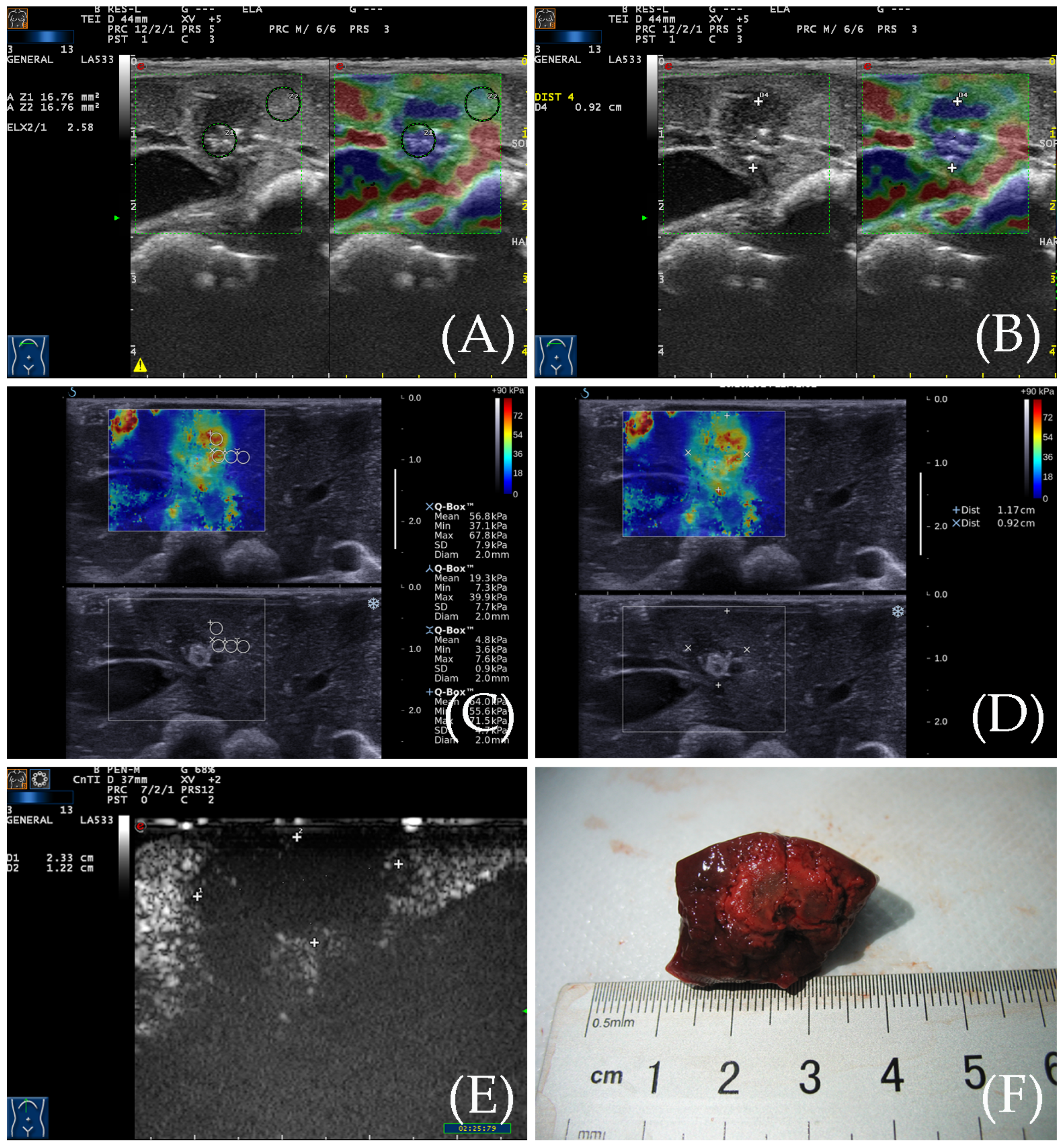 Diagnostics 13 01145 g003 Diagnostics 13 01145 g003