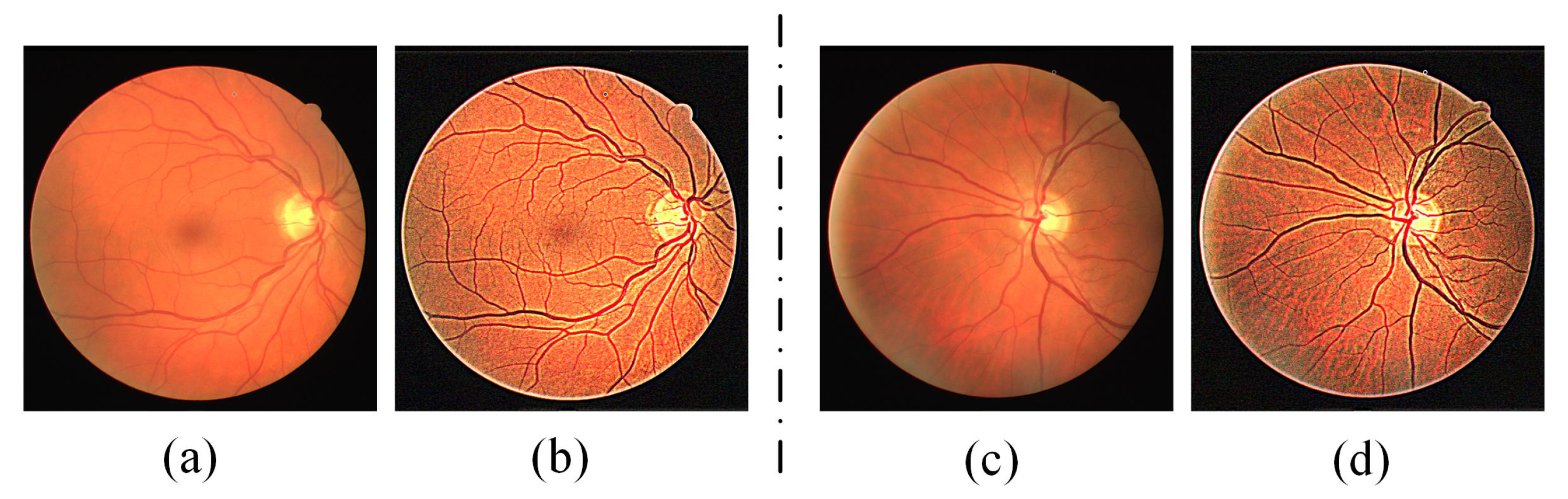 Diagnostics 13 01148 g002