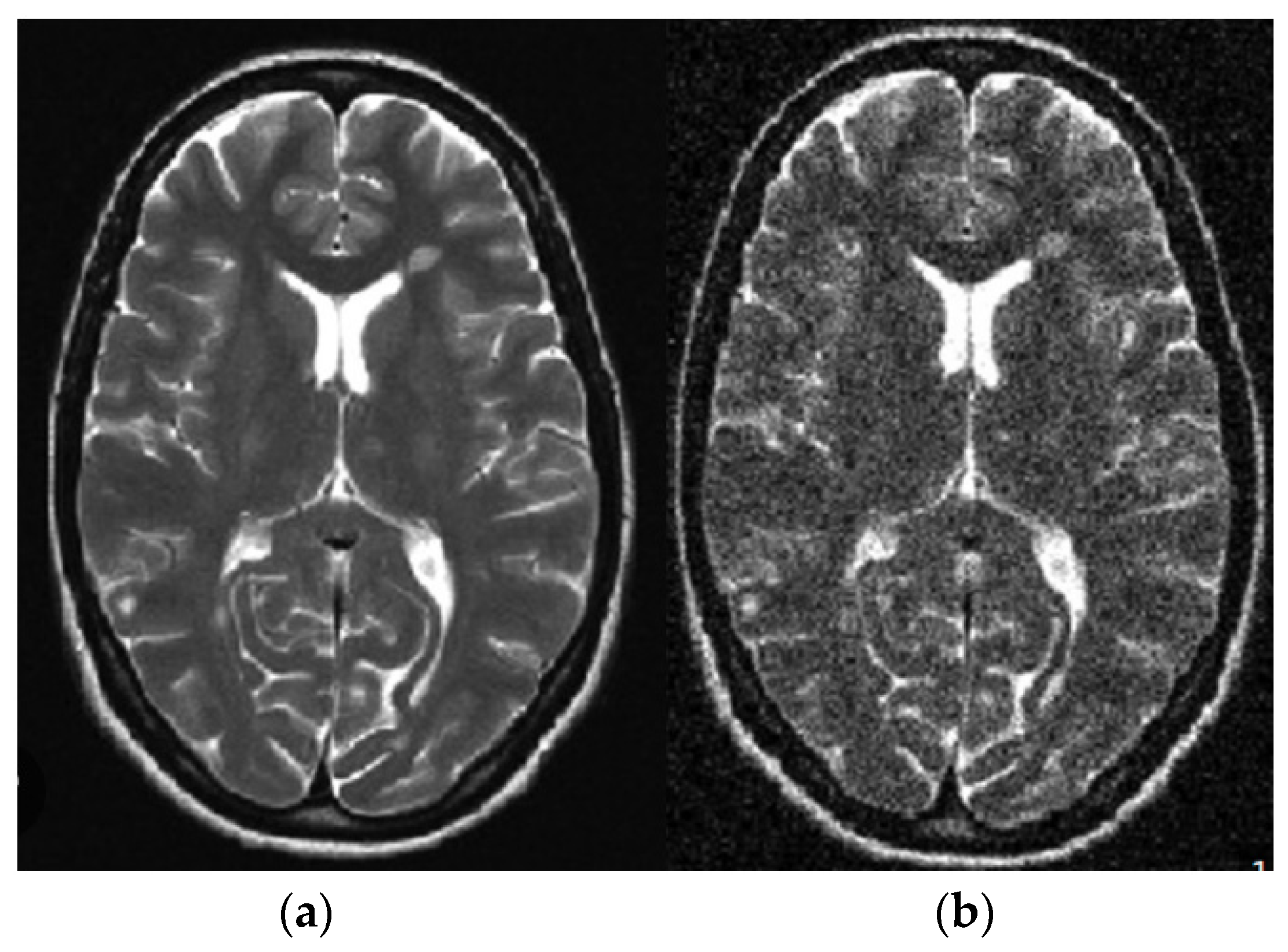 Diagnostics 13 01153 g003 Diagnostics 13 01153 g003